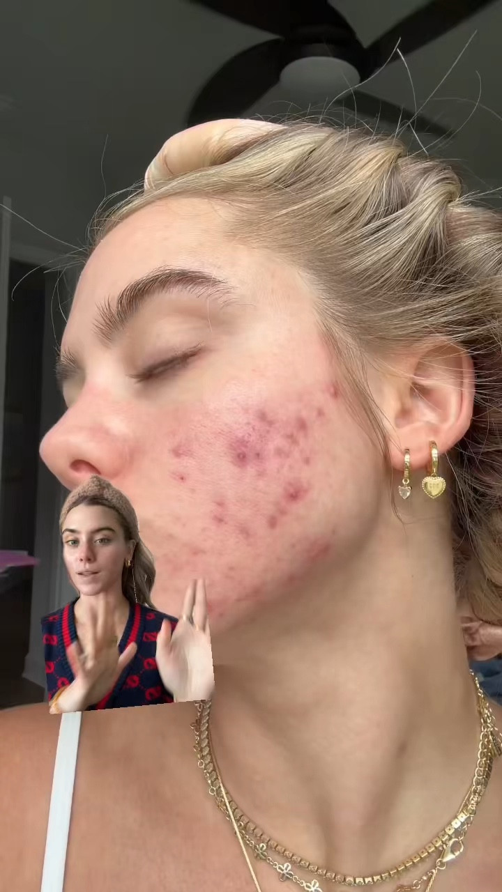 I did my muscle testing in St. Pete at Dr. Yingling at Florida Chiropractic Clinics (dryingling.com)

#LTKgrwm #LTKstorytime #LTKBeauty