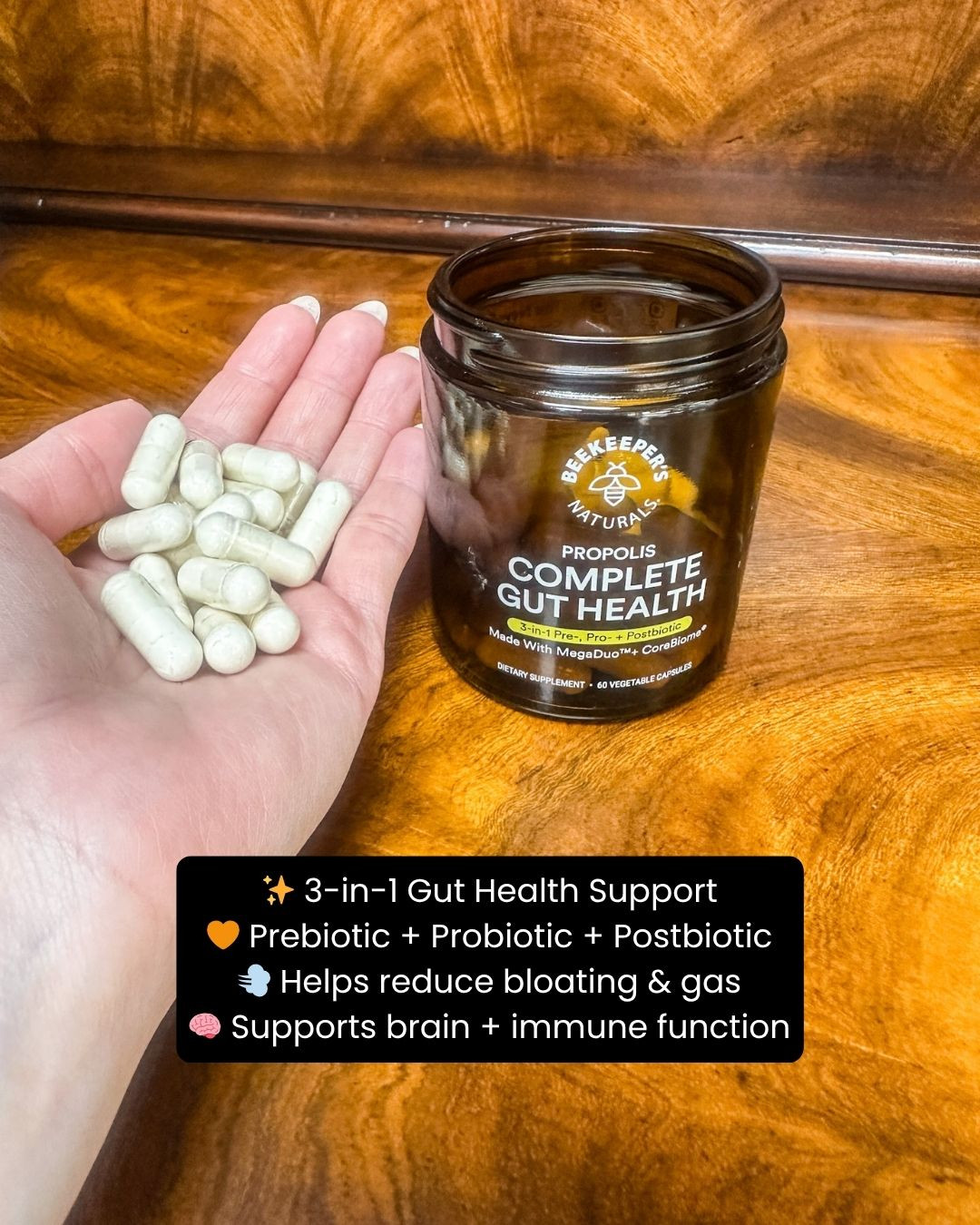 Give your body the support it deserves with Complete Gut Health by Beekeeper’s Naturals 💛🌿✨ Designed to promote a healthy gut and balanced digestion, this daily supplement helps you feel lighter, energized, and refreshed from the inside out 💫 Wellness starts here!

#WellnessEssentials #GutHealthSupport #Beekeepers #LTKWellness #HealthyLifestyle #AmazonFinds #DailyWellness #DigestiveCare #FeelYourBest #SelfCareDaily #NaturalSupport #LTKFinds #HealthJourney #BalanceFromWithin #WellnessGoals 

 