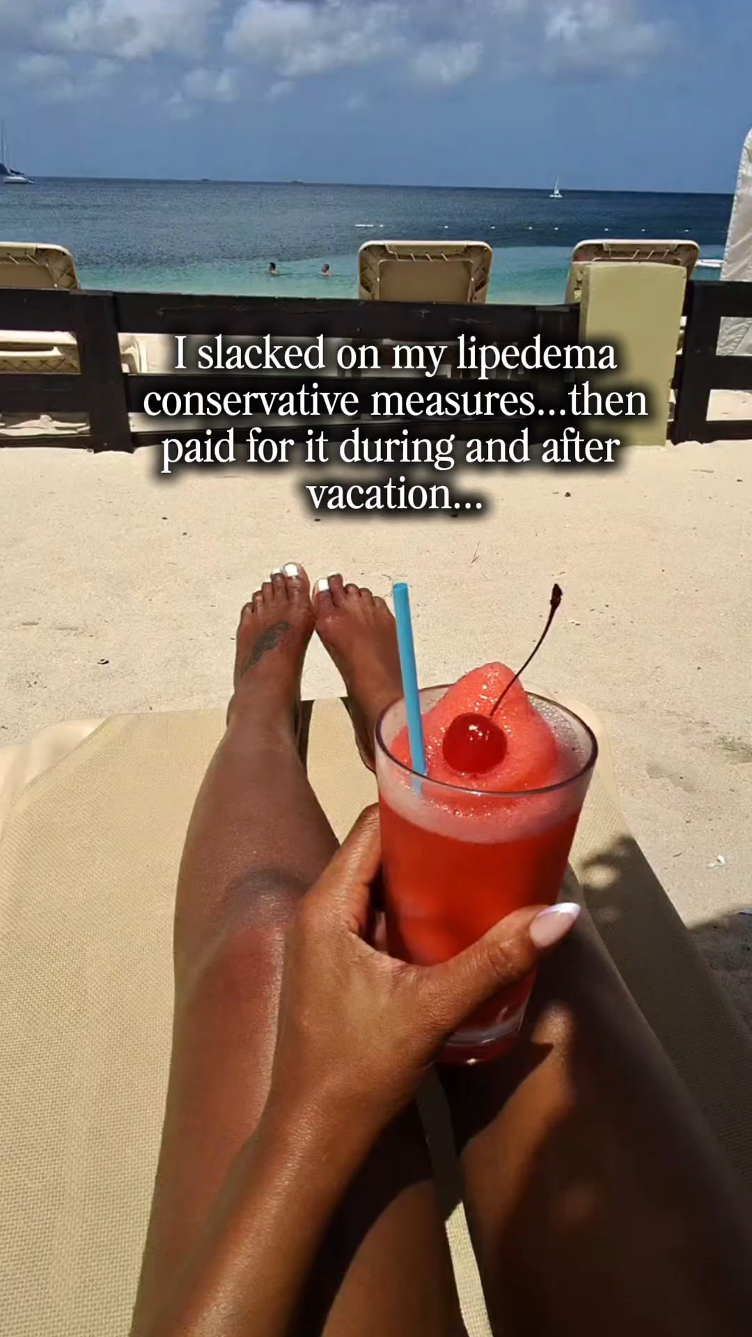Vacation was amazing... but my legs definitely let me know when I got home. 🫠Living with lipedema means even a week of less compression, more sitting, flying, heat, and salty foods can leave me swollen, achy, and feeling like I gained way more than I actually did.Got back on my conservative measures and realized it wasn't a "weight gain" problem...it was inflammation and fluid.So it was back to the basics 👇🏾✔️Getting back into my routine✔️Medical-grade compression✔️Compression pump✔️Fascia Blasting ✔️Hydration A few days later, I was already feeling like myself again.Lipedema isn't just about how your legs look (bc my still look textured) . It's about managing a lifelong condition, and sometimes vacations come with a little recovery period too. 💙If you have lipedema, you're not imagining the swelling after travel. Your body is just asking for a little extra care. #neurodivergentmom360 #LipedemaAwareness #CompressionTherapy #LymphaPress #LipedemaJourney  

#LTKselfcare #LTKstorytime