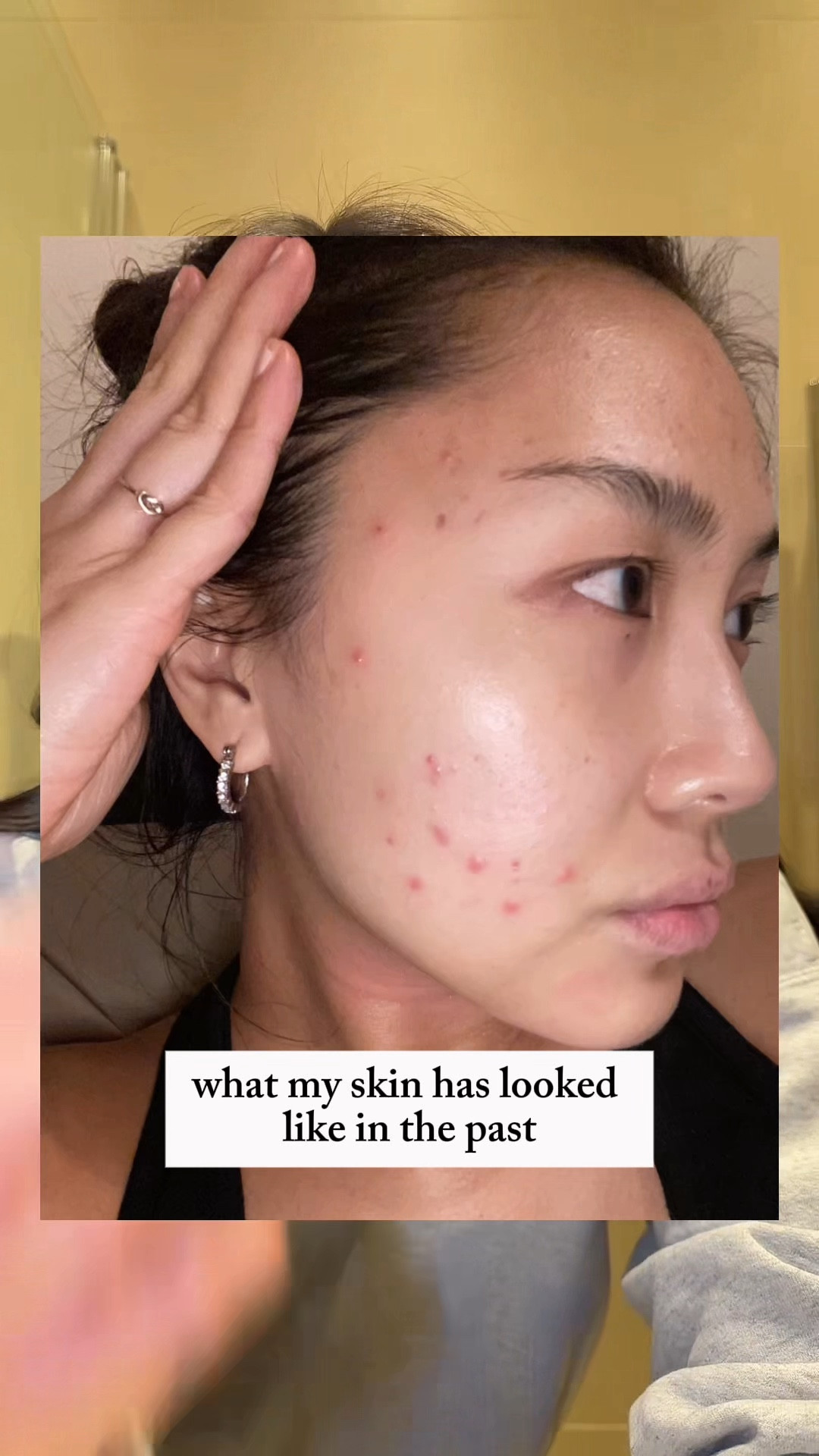 a few skincare empties and what I replaced them with 🪞✨ let me know any skincare questions you may have about my acne journey, how I got rid of texture/ scarring etc and I’ll do a separate video xx 

@shuuemura - oil cleanser 
@versed - balm cleanser 
@aprilskin_global - balm cleanser 
@byoma - milky cleanser 
@aestura_us foaming cleanser 

#skincare #empties #acne #skincareroutine #journey

#LTKBeauty #LTKSaleAlert #LTKselfcare