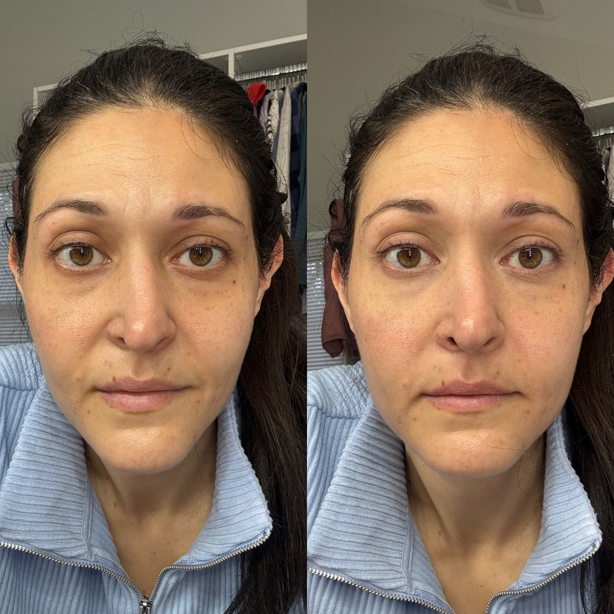 My TOP beauty product in action. The Bobbi Brown under eye corrector. When you find the right shade for you, it’s a magical product that makes you look more awake, without looking like you’re wearing anything. If I had to get rid of all my products but one, this would be it! I wear it alone and also under concealer.

#LTKOver40 #LTKBeauty #LTKHoliday