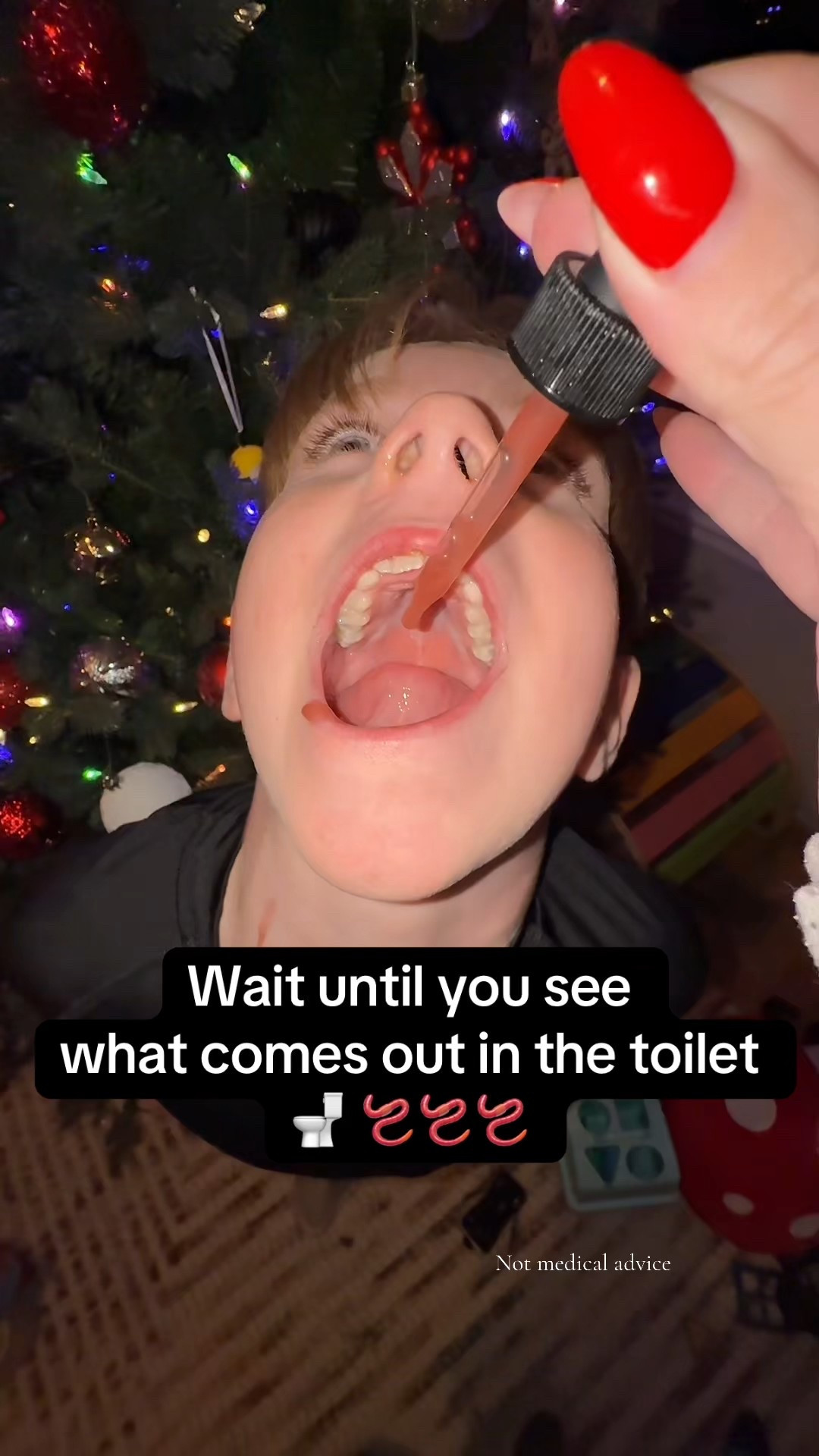 Parasites aren’t just a “third-world” issue 🪱 they can affect kids everywhere.
From sugar cravings and tummy aches to poor sleep and irritability, parasites can show up in subtle ways we often overlook.
Awareness is the first step. Healthy kids start with a healthy gut. 🤍

#parasitecleanse #guthealth #detox

#LTKmomlife #LTKdayinmylife #LTKKids