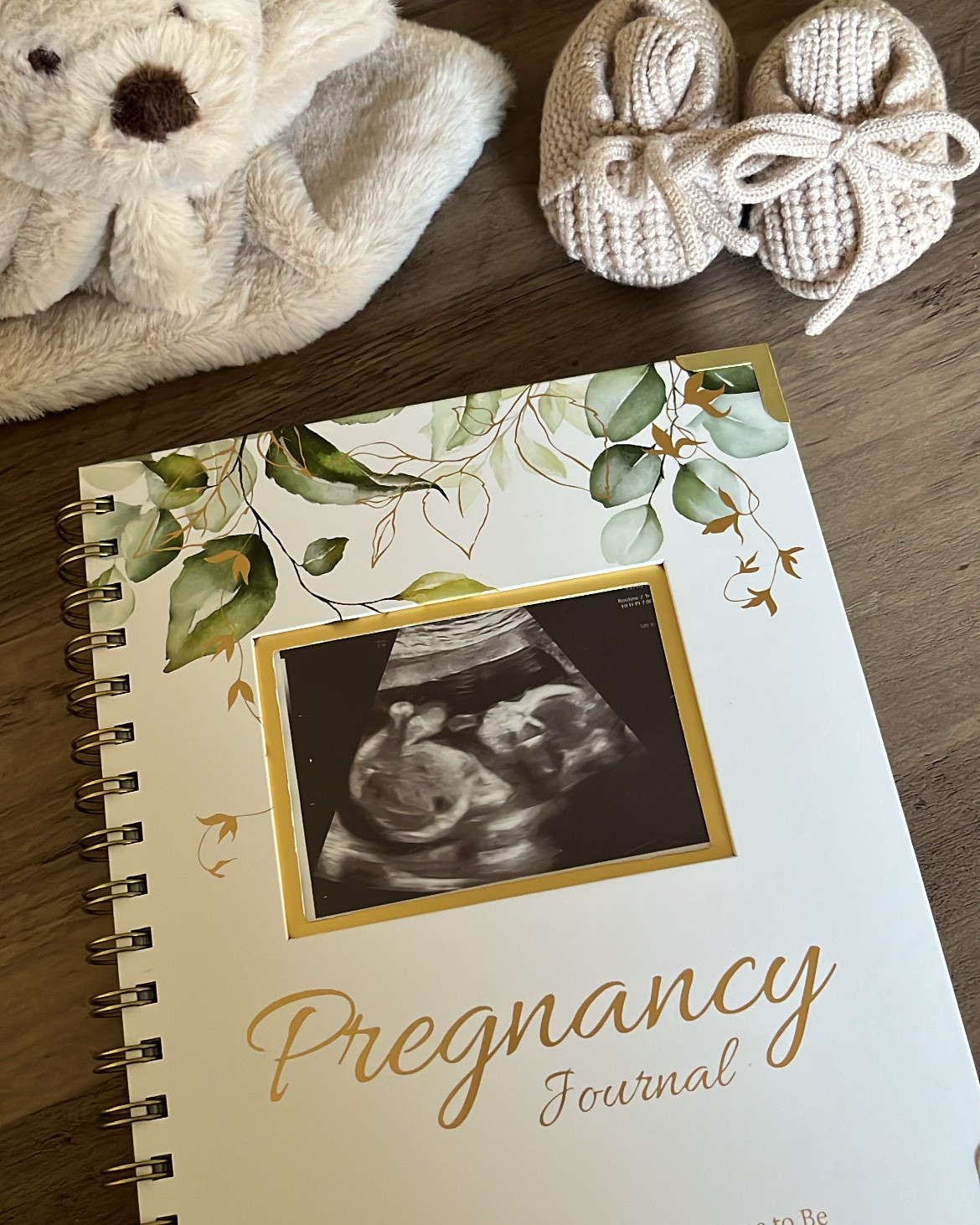 Great pregnancy journal to treasure all those special moments #pregnancyjournal 

#LTKBump #LTKBaby #LTKKids
