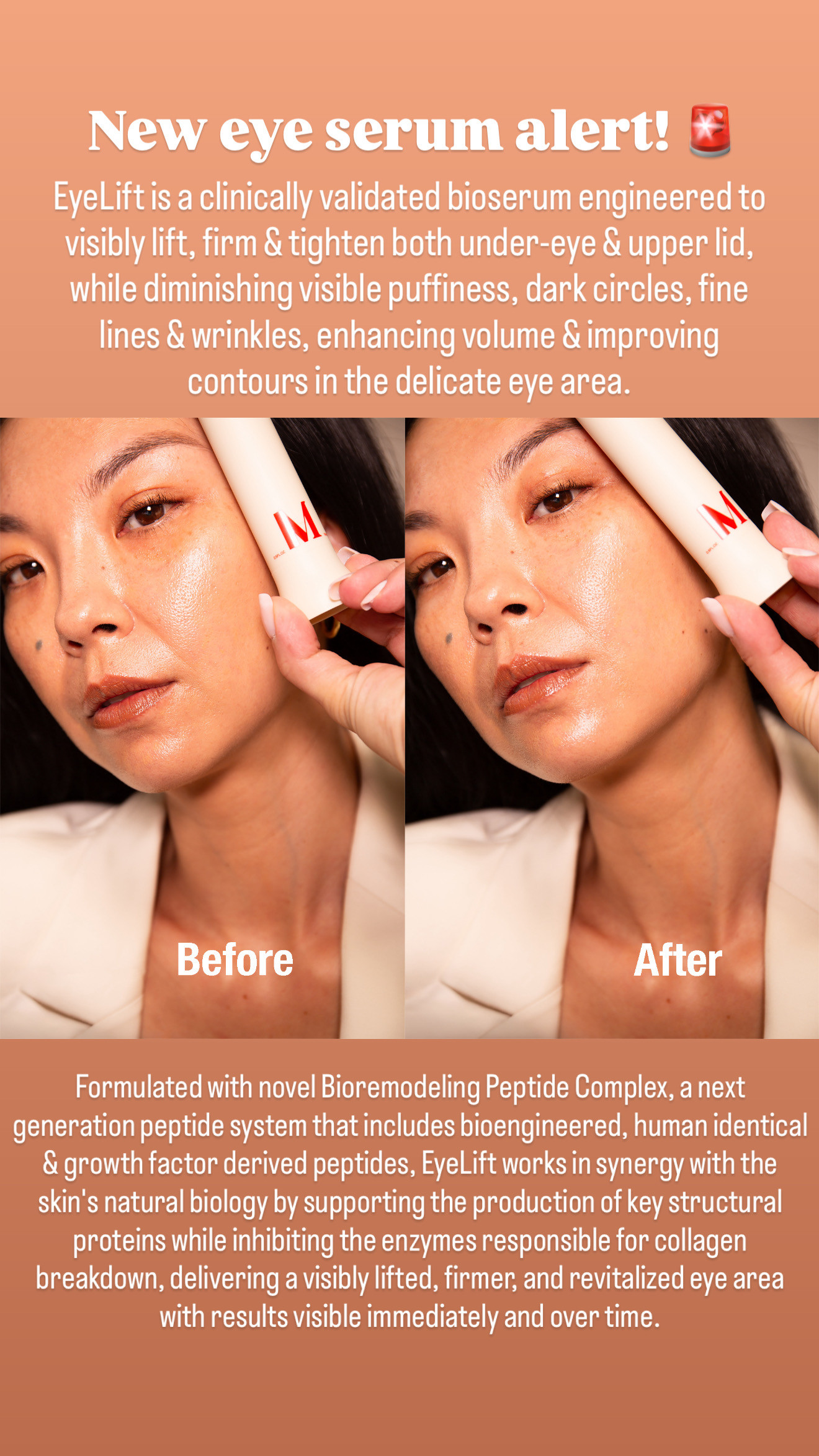 EyeLift is a clinically validated bioserum engineered to visibly lift, firm & tighten both under-eye & upper lid, while diminishing visible puffiness, dark circles, fine lines & wrinkles, enhancing volume & improving contours in the delicate eye area. 

Formulated with novel Bioremodeling Peptide Complex, a next generation peptide system that includes bioengineered, human identical & growth factor derived peptides, EyeLift works in synergy with the skin's natural biology by supporting the production of key structural proteins while inhibiting the enzymes responsible for collagen breakdown, delivering a visibly lifted, firmer, and revitalized eye area with results visible immediately and over time.

 

OPHTHALMOLOGY TESTED. SAFE FOR CONTACT LENS WEARERS.

 
EyeLift is the first treatment in the CONTOUR COLLECTION, inspired by Dr. Jason Diamond's non-surgical Diamond Facial Contour procedures. 

 

 #LTKMothersDay #LTKOver40 #LTKBeauty