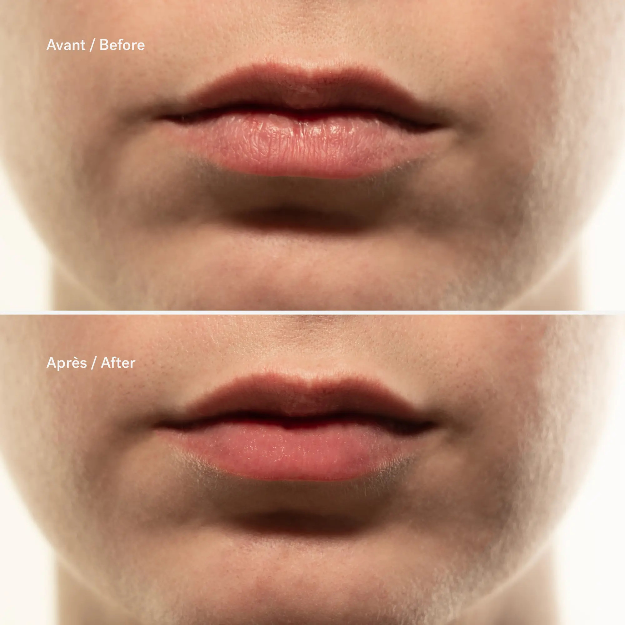 Repairing Lip Mask with Hyaluronic Acid — Typology | Typology - US
