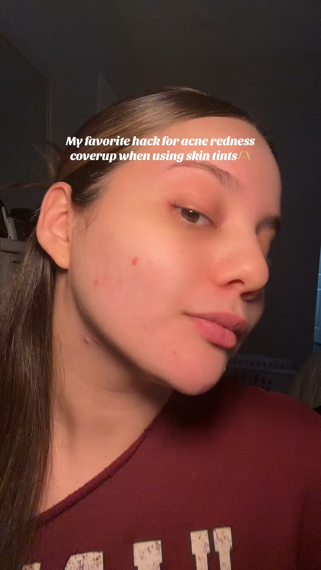 Best concealer to cover redness under skin tint!📢👀🤫

#LTKgrwm #LTKBeauty