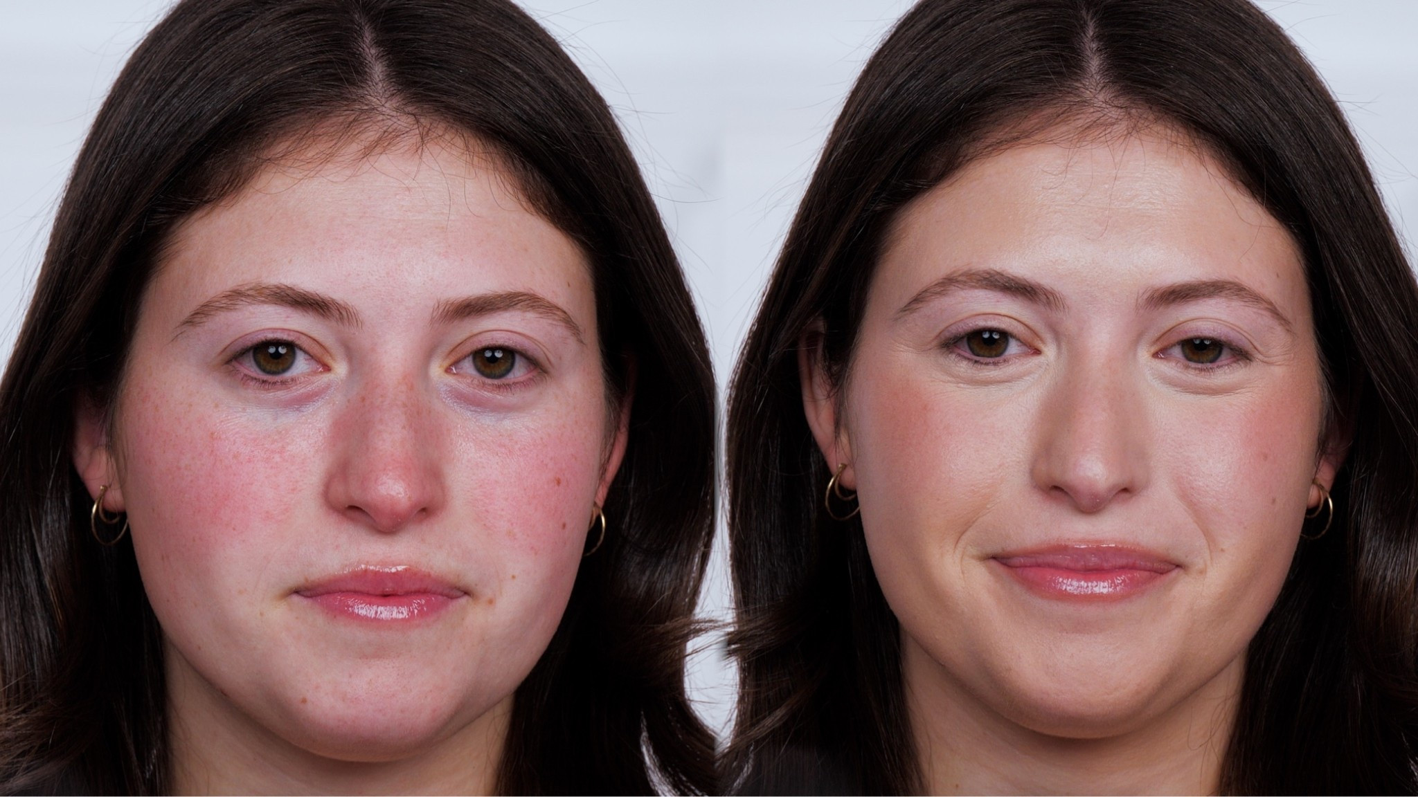 How to Rosacea now live on Makeup By Kelli Anne