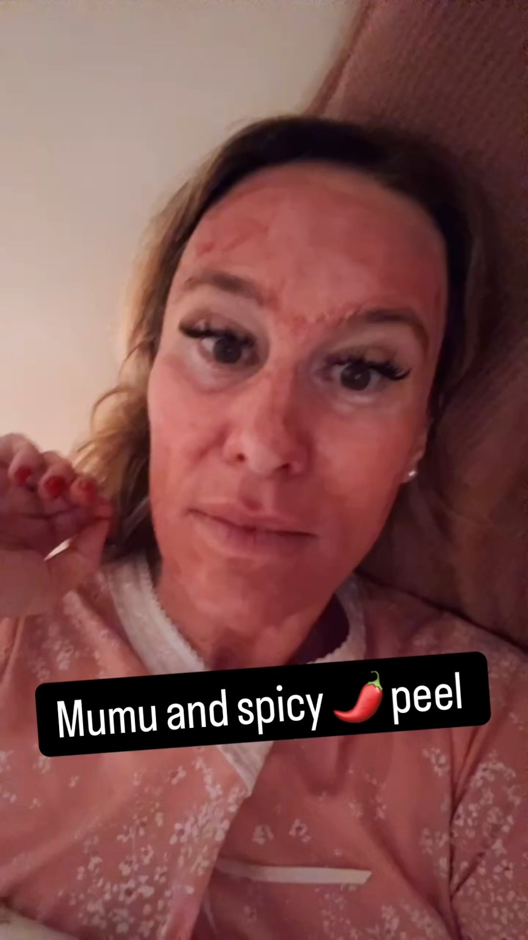 This is the best at home peel on the market and such a great price .  I have used it for years . 