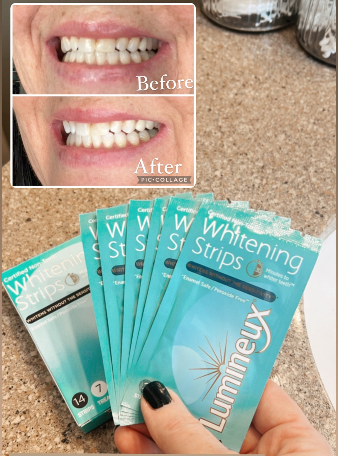 Im a coffee drinker so I use these once a week or every other week. No sensitivity at all. This is 30 mins between.  

#LTKstyletip #LTKU #LTKbeauty