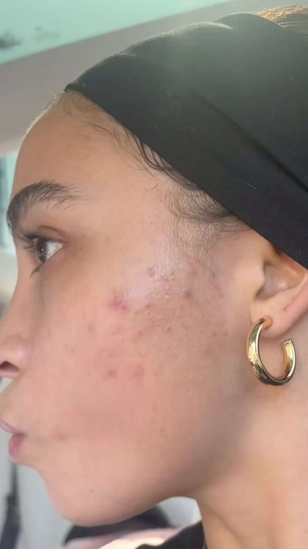 Acne safe makeup all 2026

#LTKselfcare #LTKBeauty #LTKgrwm