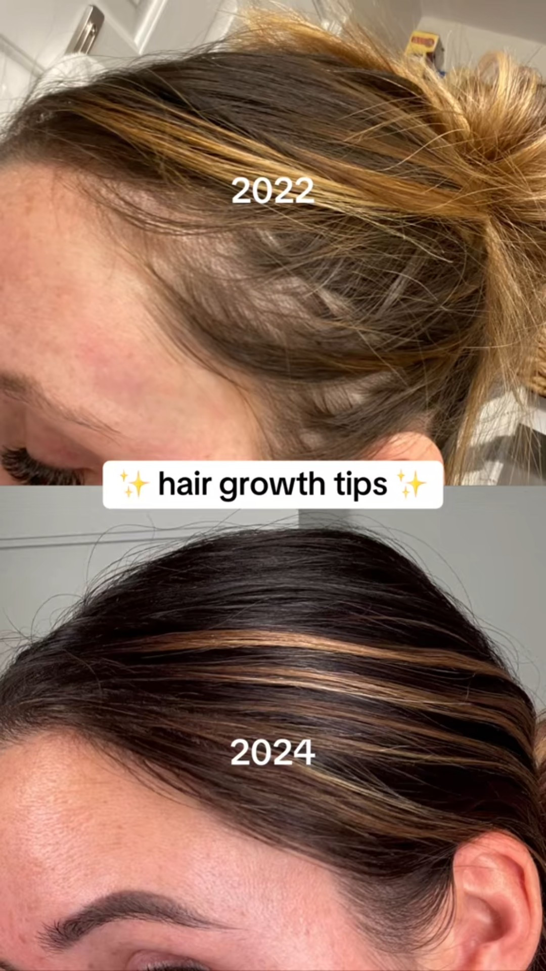 my hair oil mask routine that worked WONDERS on my hair thinning

#LTKselfcare