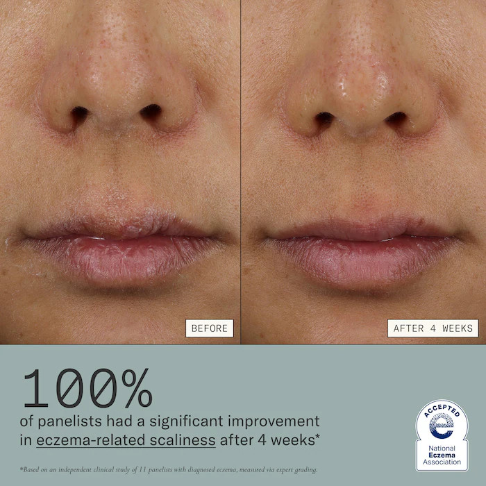 Skin Mercy Intense Recovery Cream for Sensitive & Eczema-Prone Skin | Sephora (US)