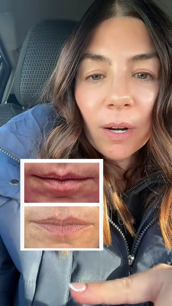 Loving my Volufiline results so far!  Plumper, healthier looking lips, using 2x per day.  Only $22!

#LTKBeauty #LTKOver40 #LTKmorningroutine