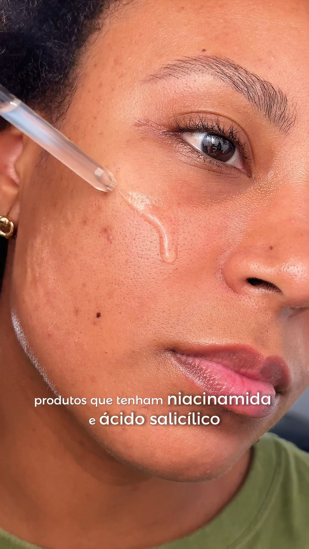 Bora cuidar dos poros?

Agora que a gente já sabe o quanto que eles são essenciais pra saúde da nossa pele, segue a lista de indicações:

Produtos com Retinol
Sérum Anti-Idade @principiaskincare Retinol 0,3% + Vitamina E
Óleo Antissinais Com Retinol @sallve 
Gel Creme Redutor de Rugas @oboticario Botik Retinol Puro
Sérum Antirrugas @larocheposaybr Retinol B3
Creme Facial @oficialadcos Derma Complex Retinol + Ácido Hialurônico

Produtos com Ácido Salicílico e Niacinamida
Sérum Secativo Ácido Salicílico Natural @simpleorganic 
Hidratante Facial com Niacinamida e Ácido Salicílico @principiaskincare 
Sérum com Niacinamida e Ácido Salicílico @oceane 

Todos esses produtos estão na minha LTK 

#skincaretips #dicasdebeleza #acidoretinoico #acidosalicilico #niacinamide #niacinamida #cosmeticos

#LTKbrasil #LTKbeleza