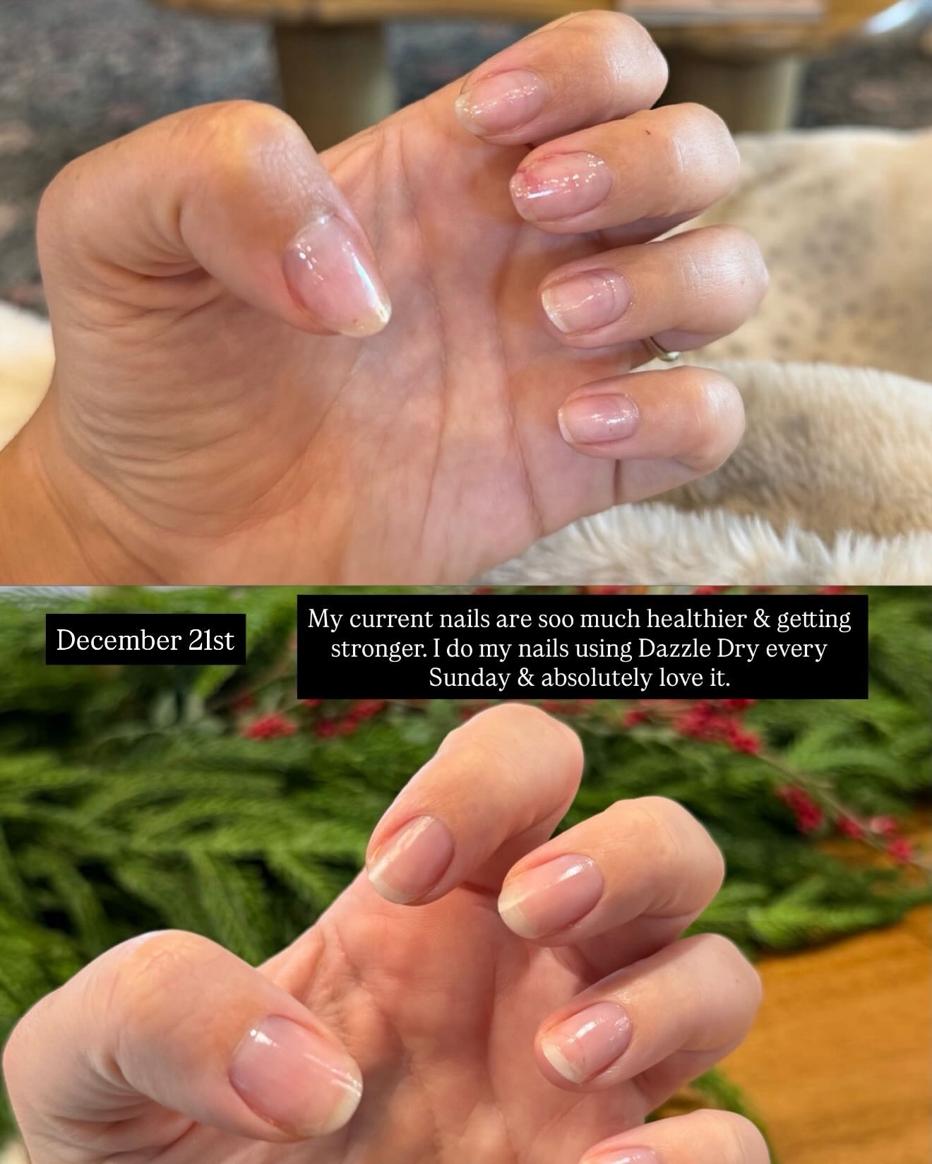 At home nail day - before & after. 
I actually love doing my nails at home now. It’s easy, painless, and kind of therapeutic.

How to:
I remove old polish with polish remover and a cotton round. Then I soak my hands in warm water for a few minutes & then apply cuticle remover to each nail (one at a time). I use the cuticle pusher to push down the cuticle and wipe clean with a paper towel. I file them to my liking and gently buff. Then I wash my hands with dawn soap & let them dry for about 30 min (this is optional). 
For the polish:
1 coat base
1 coat transform 
1 coat base
2 coats polish 
1 topcoat 
Make sure to wait until the nails look matte in between steps & wait 5 minutes after both the last coat of polish & after the topcoat. Once your time is up, nails are good to go for 7 days  

#LTKBeauty #LTKselfcare