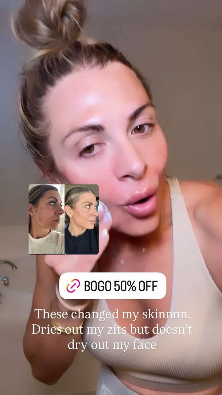 BOGO 50% OFF and these glycolic peel pads are still my skincare MVP. They help dry out breakouts without drying my skin and completely changed my routine. ✨🤍🙌 #GlycolicPeelPads #AcneProneSkin #ClearSkin #SkincareRoutine #GlowingSkin #BeautyFavorites #HealthySkin #Exfoliation #SkincareSale #SmoothSkin 

 #LTKBeauty