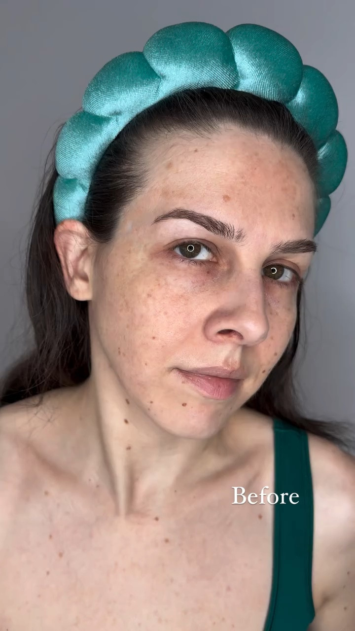 I received the NEW Azelaic Acid 10 Hyaluron Redness Soothing Serum from @anua_global and I have been enjoying it! Green is also my favourite colour so I was instantly drawn to this product! 

💚 It’s lightweight and treats skin concerns like acne and rosacea. The formula is calming as it contains Azelaic Acid, Panthenol, Aloe Juice and Centella Extract. Hyaluronic Acid delivers hydration to the skin and it also contains Niacinamide which helps to fade hyperpigmentation. 

*PR/gifted - Thank you @yesstyle 

🛒 Use code BERRZ12 at checkout to save some coins!

#LTKBeauty