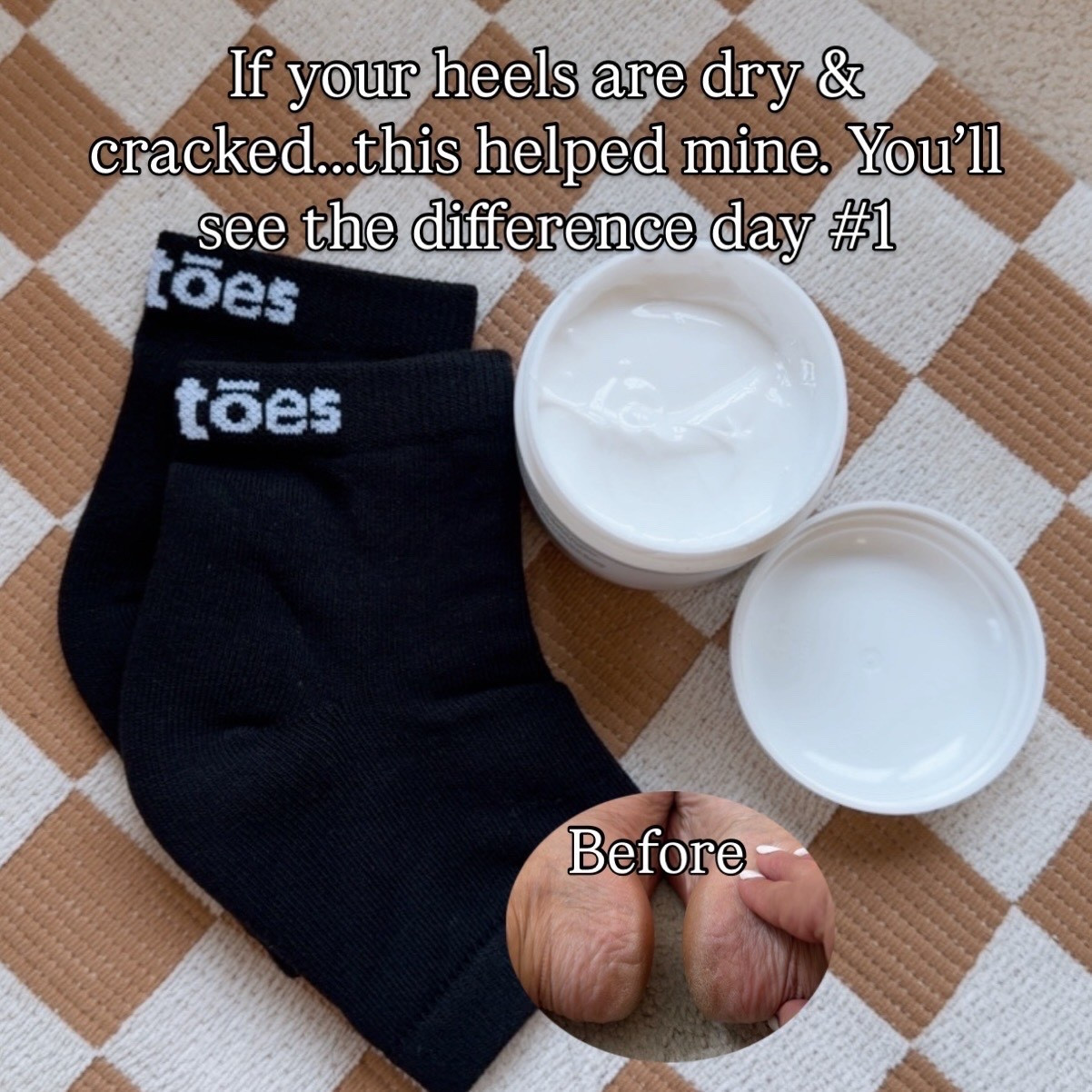 My go to Routine for Dry Cracked Heels and the perfect Moisturizing socks that I don’t remove in the middle of the night. IYKYK!

#LTKselfcare #LTKBeauty