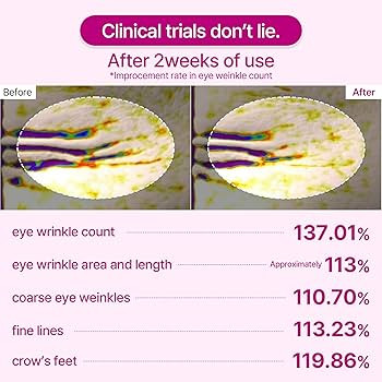 Dr.Melaxin Cemenrete Calcium Volume Eye patch 60ea | Amazon (US)