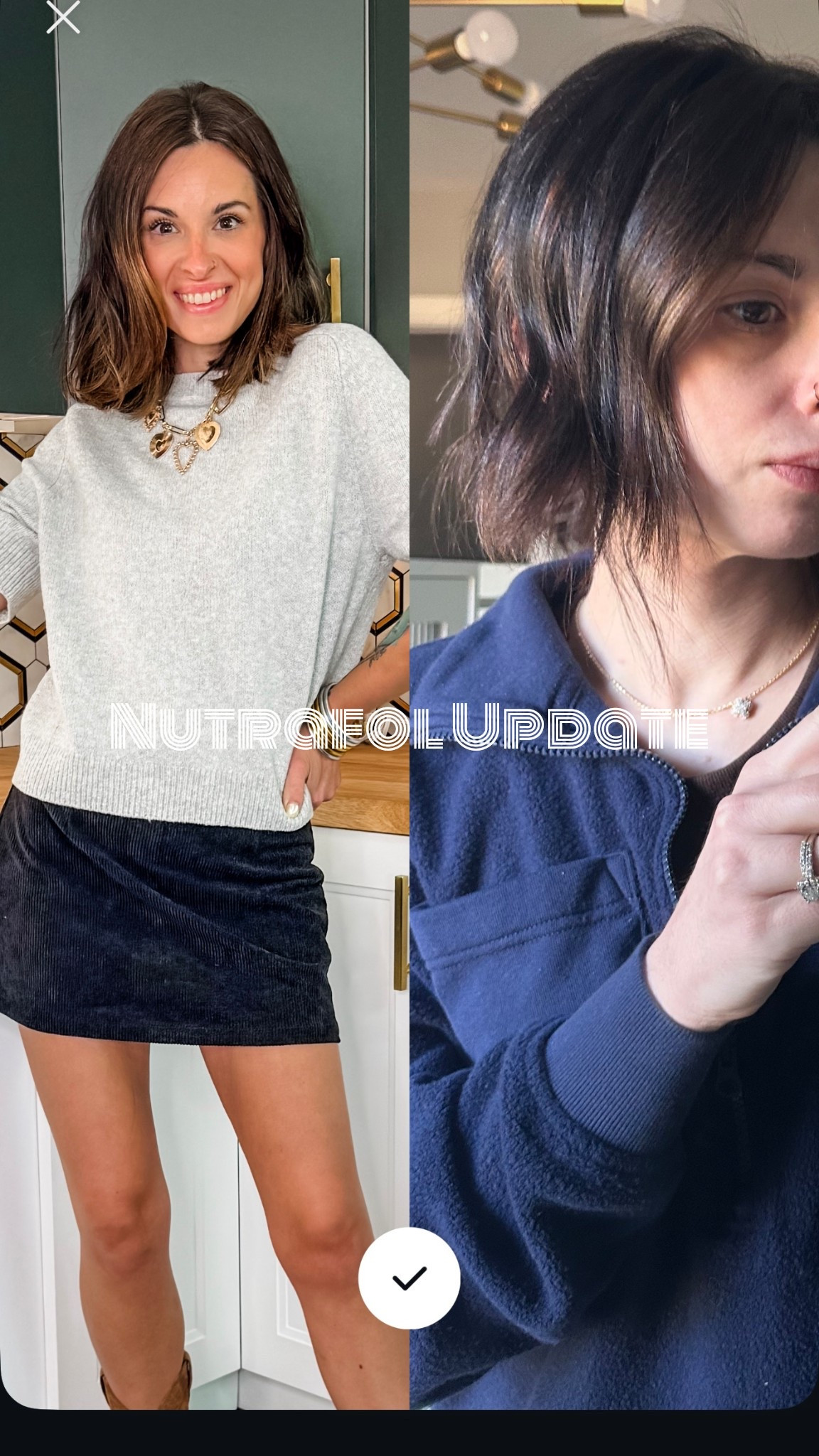 I had a terribly short haircut that just didn’t vibe back in December. The picture on the right was February-ish. The picture on the left was a week ago.

I’ve been growing my hair out and also working to get it healthy again. I went through horrible post c-vid hair loss last year and it also was terribly dry. 

Nutrafol has been the only thing that works to not only grow my hair but thicken it back up. I had bald spots on my temples from losing so much hair, but it’s all back. 

This is 7ish months of growth. Admittedly, not taking it completely consistently (I’ll randomly take weeks off) and it’s still so much healthier and growing!

I always try to remember to share this when I see posts asking for hair help! It’s pricey, but it’s been so worth it!

#nutrafol #hairgrowth #hair 

#LTKFindsUnder100