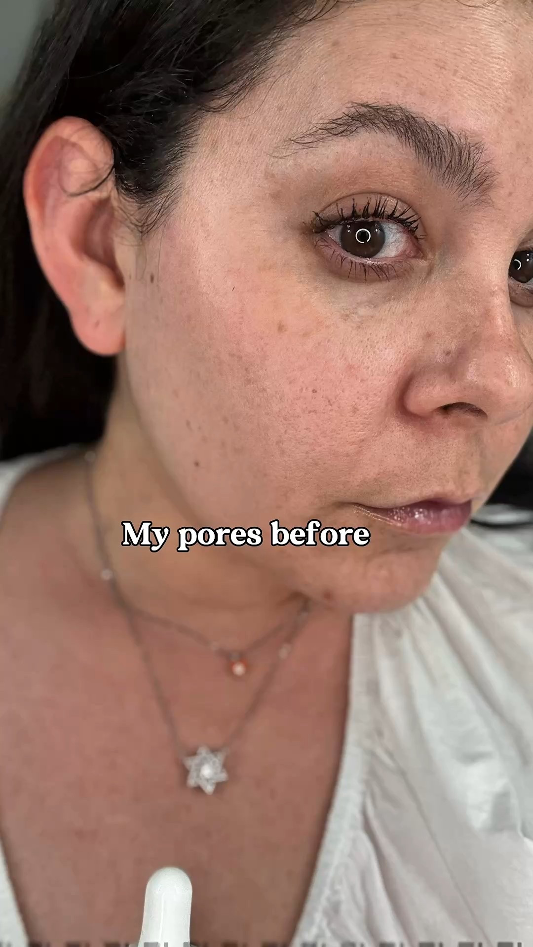 This serum from Frankly reduces pores, hydrates, and has anti-aging ingredients 🫶🏽

#LTKFindsUnder50 #LTKBeauty