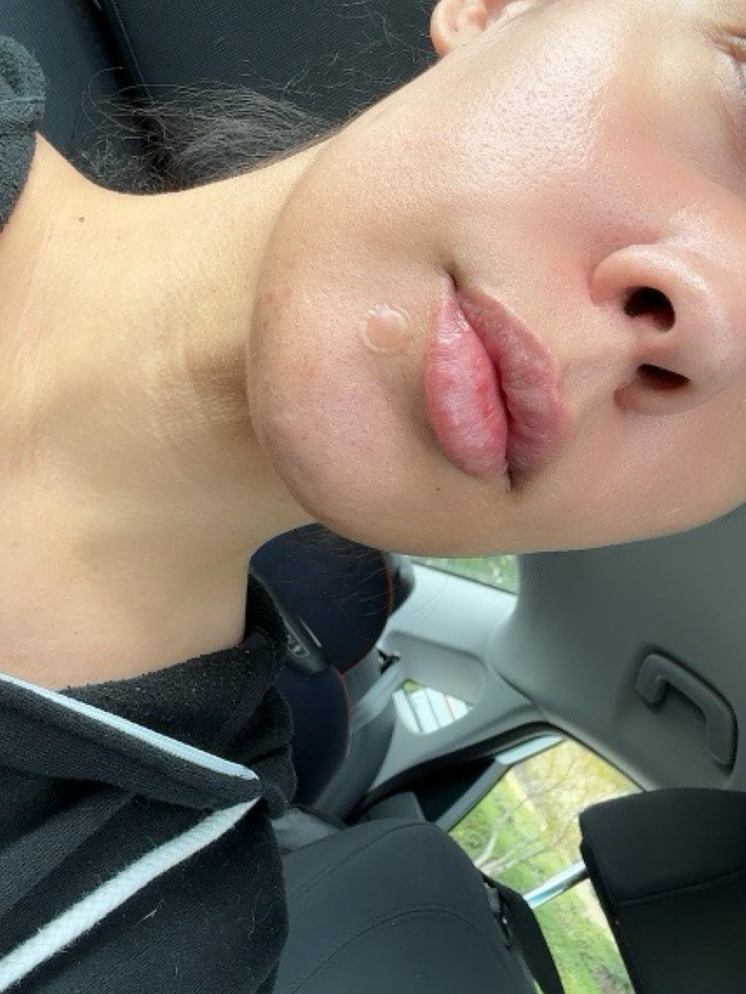 I was not expecting these mighty patch pimple patches to work so fast! I was shocked! 

#LTKbeauty #LTKU