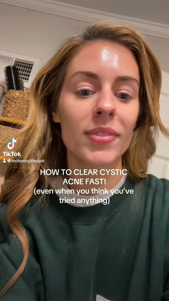 My tried and true acne products that ACTUALLY WORK 
 

 #LTKBeauty