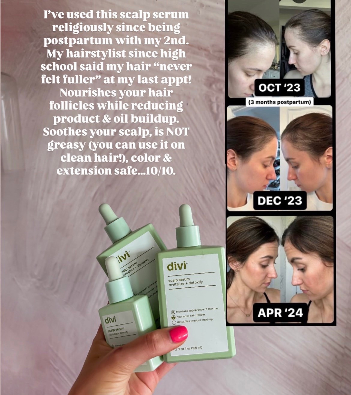 This scalp serum is AMAZING! It’s isn’t greasy, so it can be used on clean hair without any excess oil!