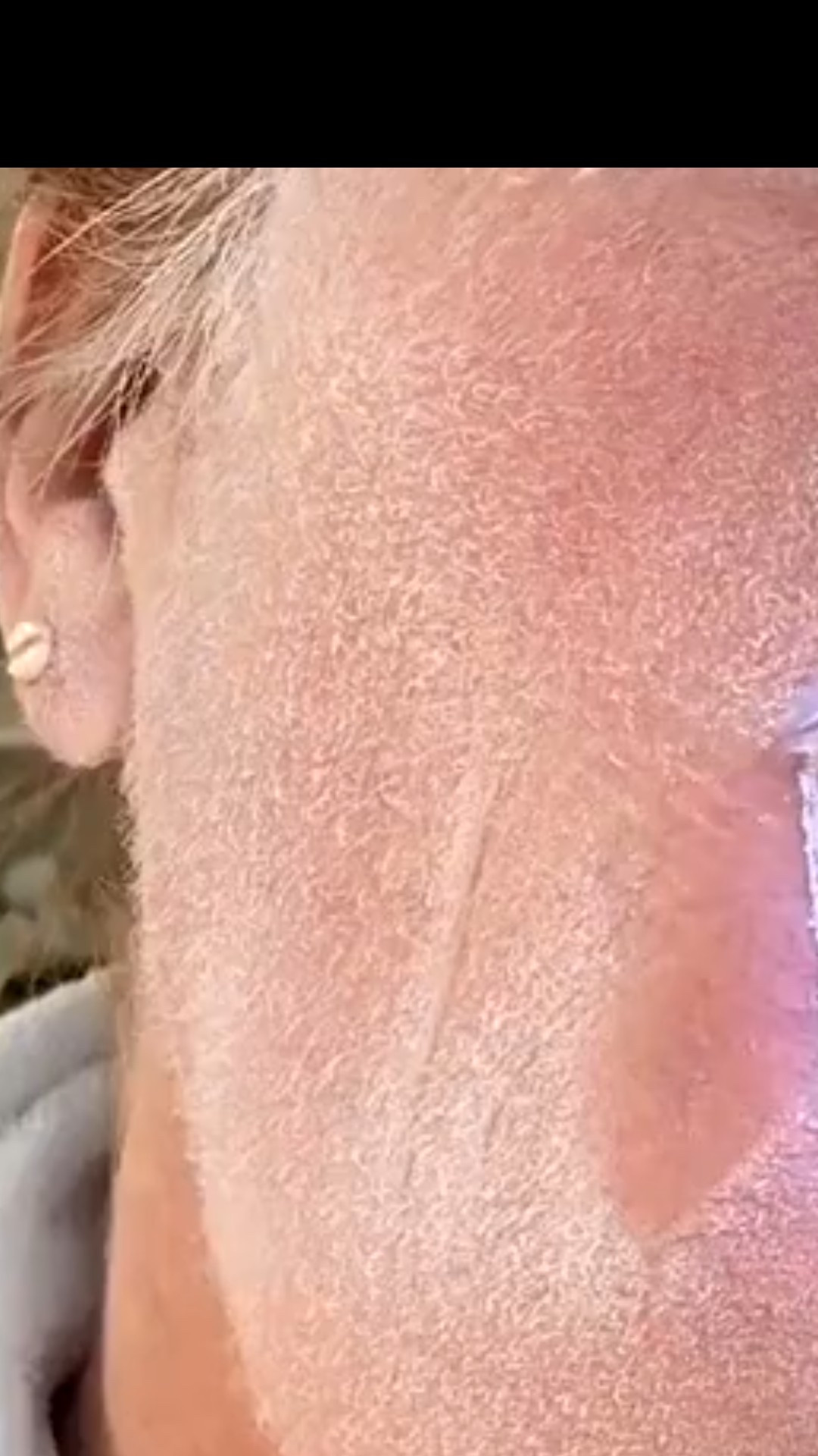 If you’re still using those tiny plastic face razors from the drugstore, we need to have a bestie intervention. 🛑 Upgrade your life with the Michael Todd Beauty Sonicsmooth Pro+. This isn't just shaving; it's sonic dermaplaning. It uses 15,000 movements per minute to gently vibrate away dead skin cells and peach fuzz that are currently sabotaging your makeup application.
The science is simple: by removing that top layer of "gunk," your expensive serums actually penetrate the skin instead of just sitting on top. It features medical-grade stainless steel blades and three different speed settings so you can customize your glow-up.

#LTKGiftGuide #LTKOver40 #LTKBeauty