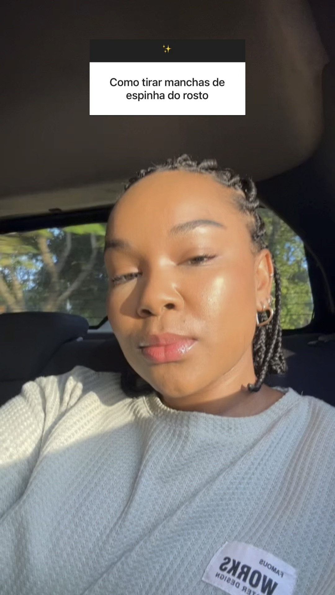 Uma das perguntas que mais recebo no direct, “qual produto você me indica pra manchas de espinha?”

Lembrando que somente um produto não irá fazer milagre o ideal é seguir uma rotina de Skincare adequada pro seu tipo de pele

no vídeo contem produtos que fazem parte da minha rotina e deram super certo, aproveita e salva pra não perder essa dica 😉🫶🏾

#skincareroutine #skincare #peleoleosa #peleacneica #manchasnapele #rotinadeskincare

#LTKbeauty