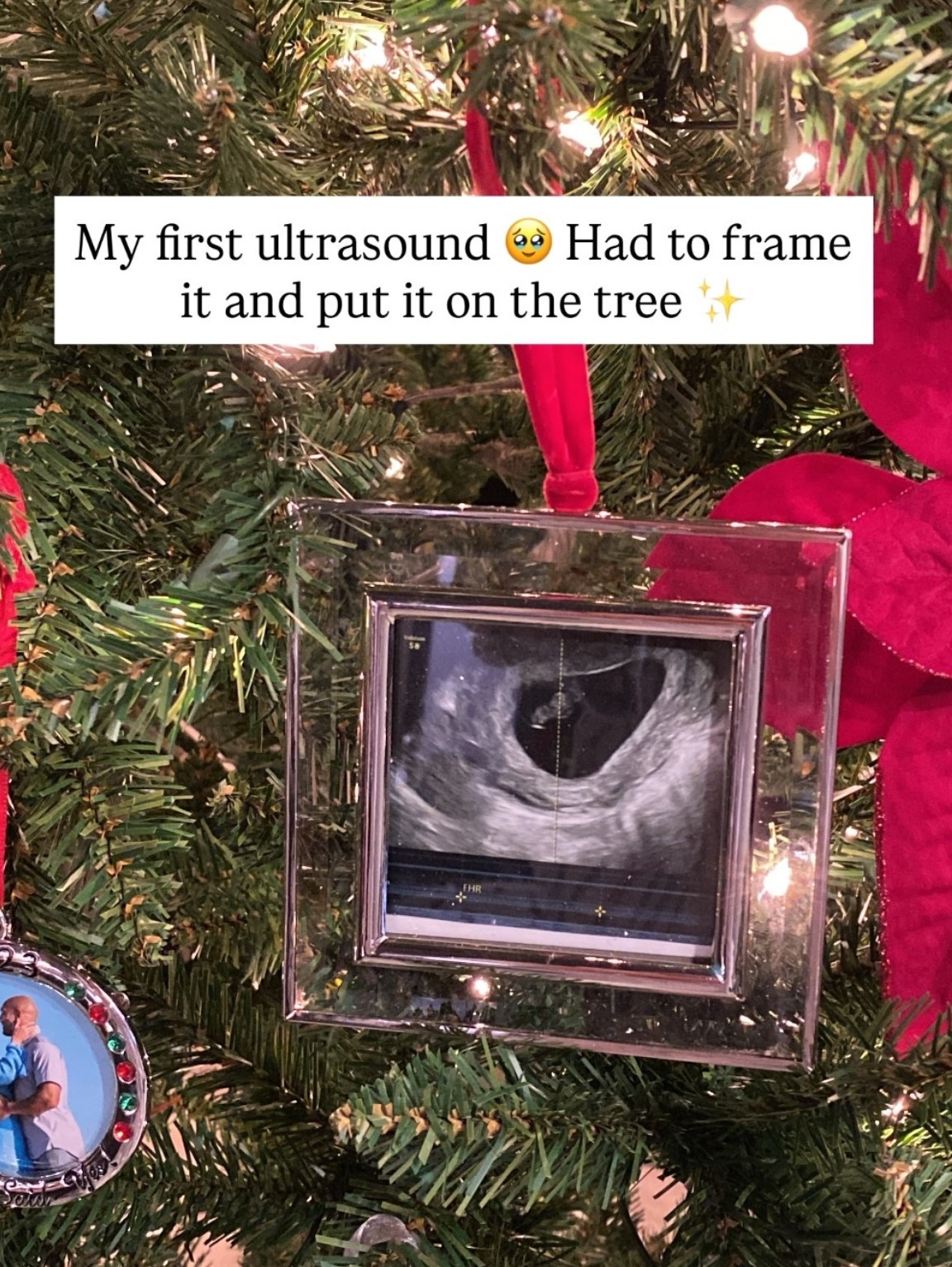 My first ultrasound 🥹 Had to frame it and put it on the tree ✨ Love picture frame ornaments to cherish those special moments!

#LTKGiftGuide #LTKHoliday #LTKHome
