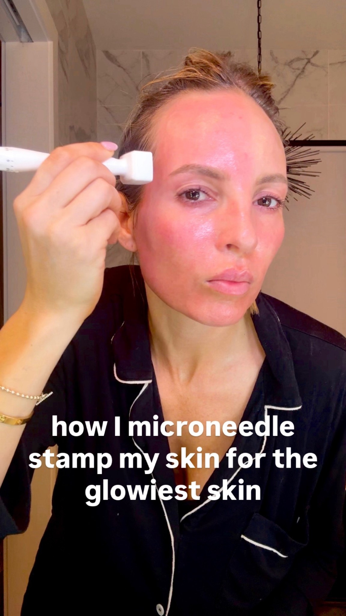 How I microneedle stamp at home (my full routine):
1.Sterilize my stamper 🧼✨
2.Double cleanse + toner to start fresh
3.Work in sections with serum in the stamper (so it never dries out)
4.Stamp ~5 times per spot until the skin looks red, then move on
• Face: 0.75 depth
• Eyes: 0.5 depth
• Neck: 1.0 depth
5.Apply leftover serum across my face
6.Add growth factor serum ➝ then hyaluronic acid
7.Seal it all in with my milky glaze + OneSkin lotion 💧
8.Overnight collagen sheet mask = non-negotiable 💤
9.Avoid any actives for the next couple of days

✨ By day two, the glow is unreal.


#LTKBeauty #LTKOver40 #LTKWedding