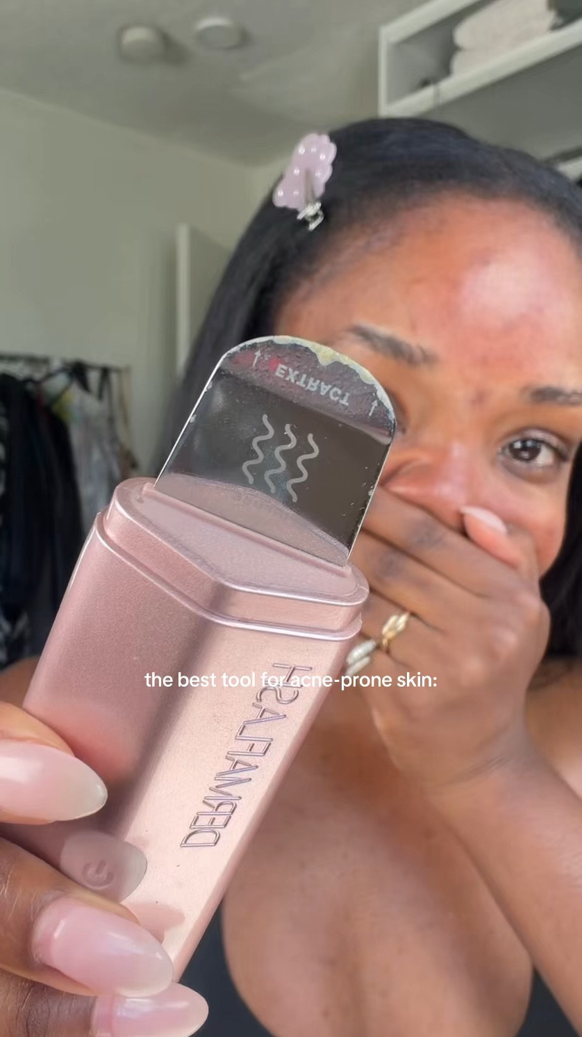 Everytime I think my face is clean 🤢 very humbling!! It looks gross but it helps unclog your pores, I’ll use a few times a week when my skin needs it (especially after wearing makeup multiple days in a row) #acneproneskin #acneskincare #skincaretools #cloggedpores #oilyskin dermaflash dermapore+ and the tower28 sos spray!

#LTKBeauty