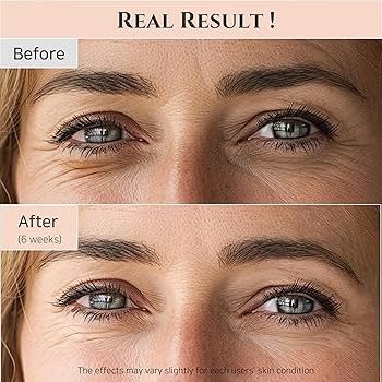Beauty of Joseon Revive Eye Serum with Retinal Niacinamide Correction for Puffy Eye Bags Fine Lin... | Amazon (US)