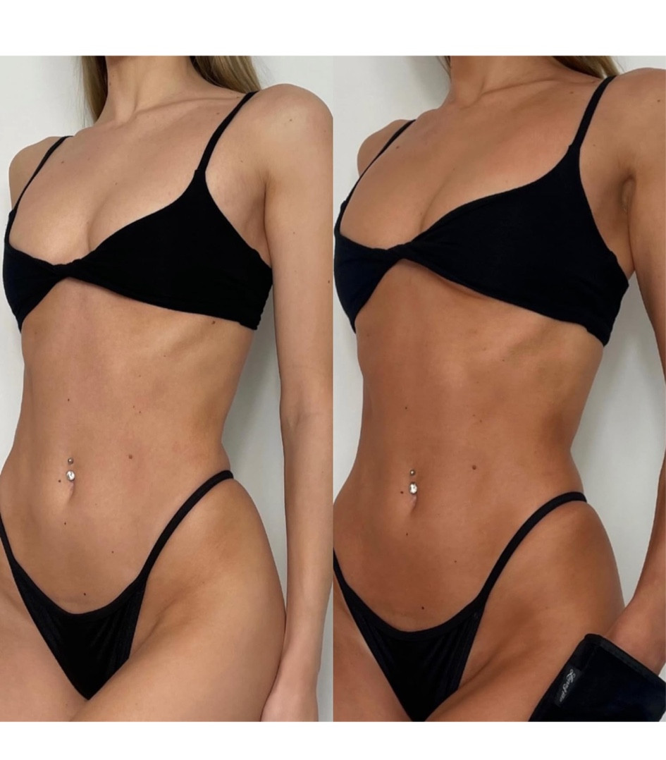 All time favorite self-tan 

#LTKbeauty