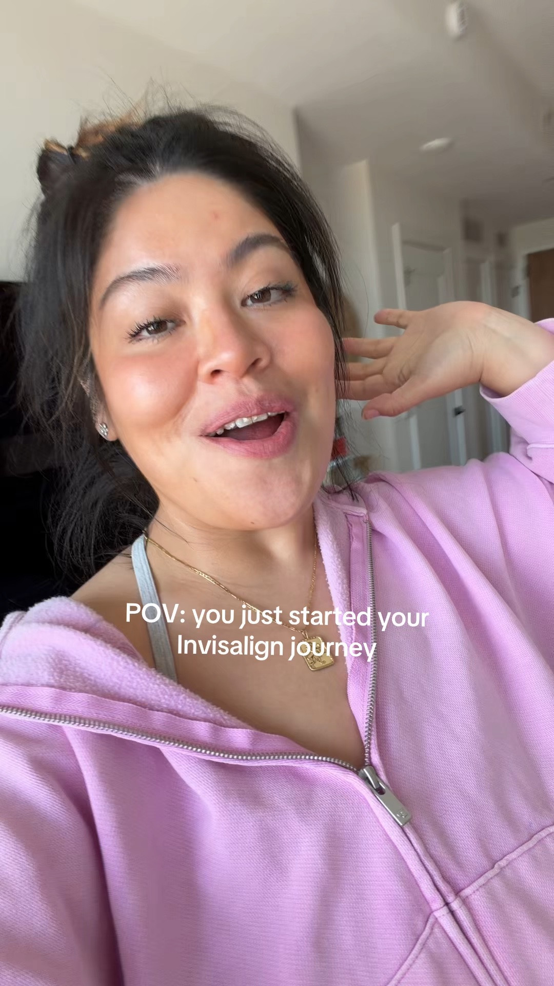 Invisalign journey

#LTKBeauty #LTKTravel #LTKselfcare