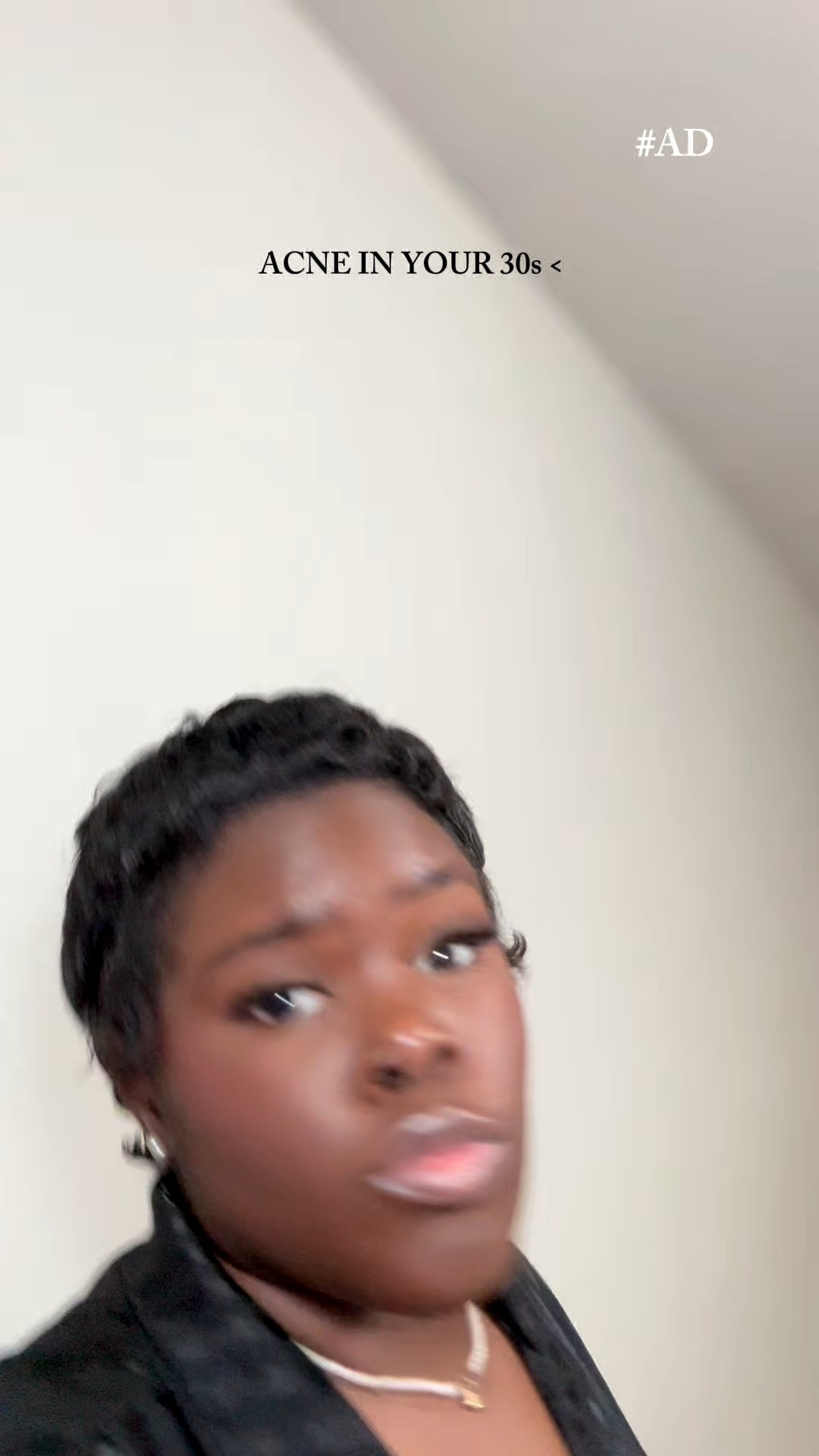 Acne in your 30s gets 0stars! Found a solution ! 

#LTKmorningroutine #LTKselfcare