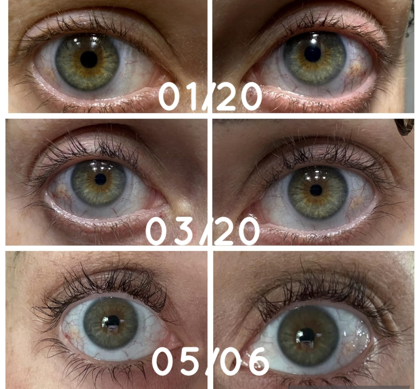 Babe Original Lash Serum - Fuller & Longer Looking Eyelashes, Advanced Lash Enhancing Treatment f... | Amazon (US)