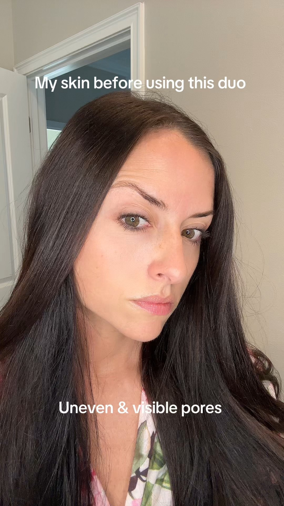 When your skincare gives you a post facial glow ! Using VT cosmetics Reedle shot & pdrn essence combo. Making my skin smooth, tighter & stronger! They have different levels but I used 100 here. 

#skincare #vtcosmetics #kbeauty #microneedle #koreanskincare #wrinkles #pdrn 

#LTKFindsUnder100 #LTKFindsUnder50 #LTKBeauty