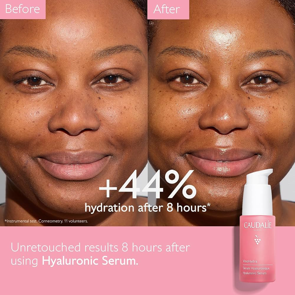 Caudalie VinoHydra Hyaluronic Acid Serum, Hydrating, Soothing, Dermatologically Tested & Vegan - ... | Amazon (US)