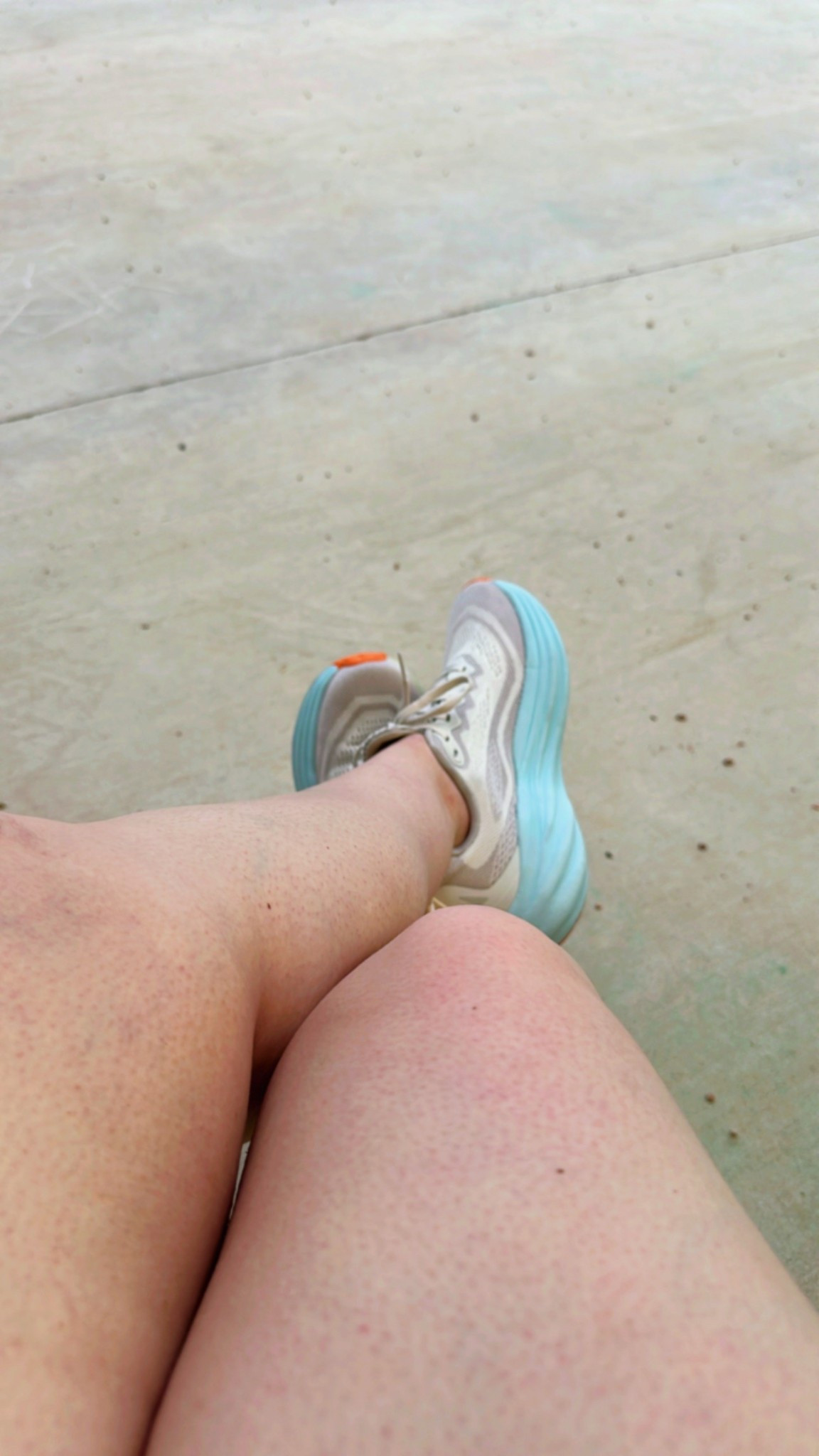 Cutest summer shoes. I’ve received so many compliments  

#LTKSeasonal #LTKShoeCrush #LTKSummerEdit