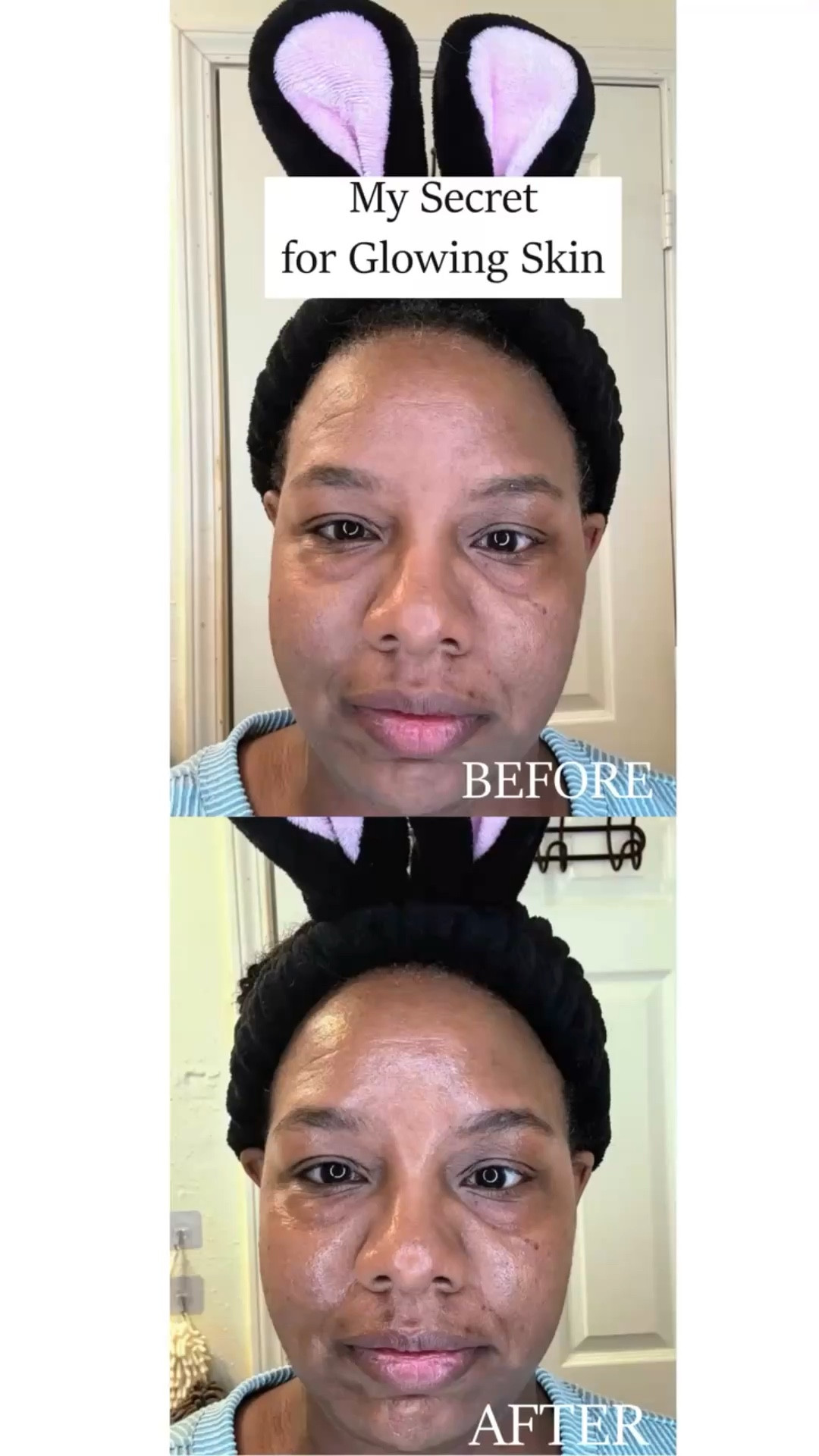 Get That Dewy Glow How to Use Esomi Balm for a Radiant Finish

#ESOMI #esomiskincare #kbeauty #koreanskincare

#LTKmorningroutine #LTKBeauty #LTKselfcare