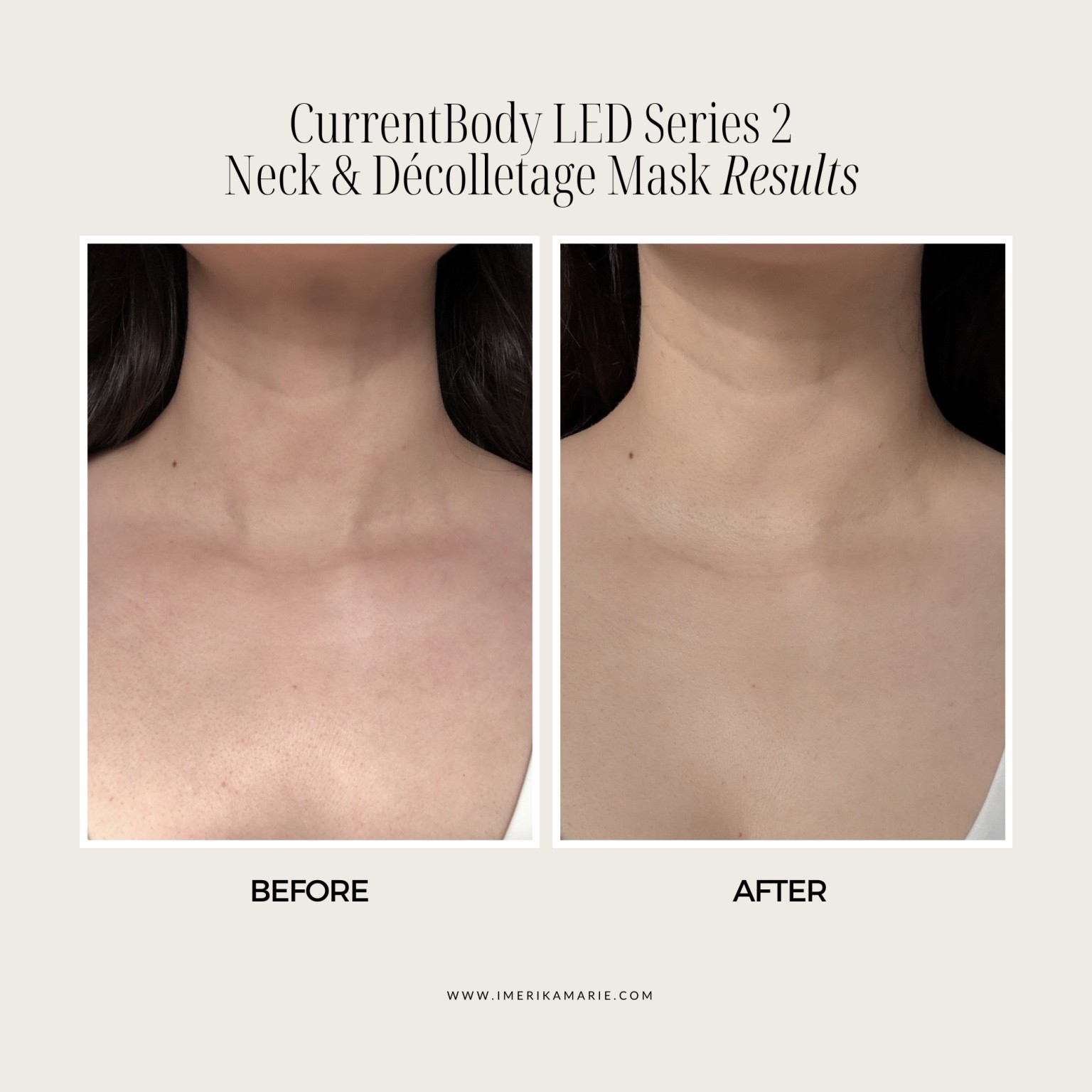 Results from the CurrentBody Red Light Therapy Neck Mask, perfect for a Mother’s Day gift 🤍

Use code “ERIKALED” to save $$

The @currentbody01 LED neck mask is my favorite for smoothing tech neck lines and reducing neck wrinkles by 30% after 8 weeks!

mother’s day gift, mothers gifts, mom gifts, ltkmothersday, mother’s day gift guide, mom skincare

#LTKmorningroutine #LTKMothersDay #LTKmomlife