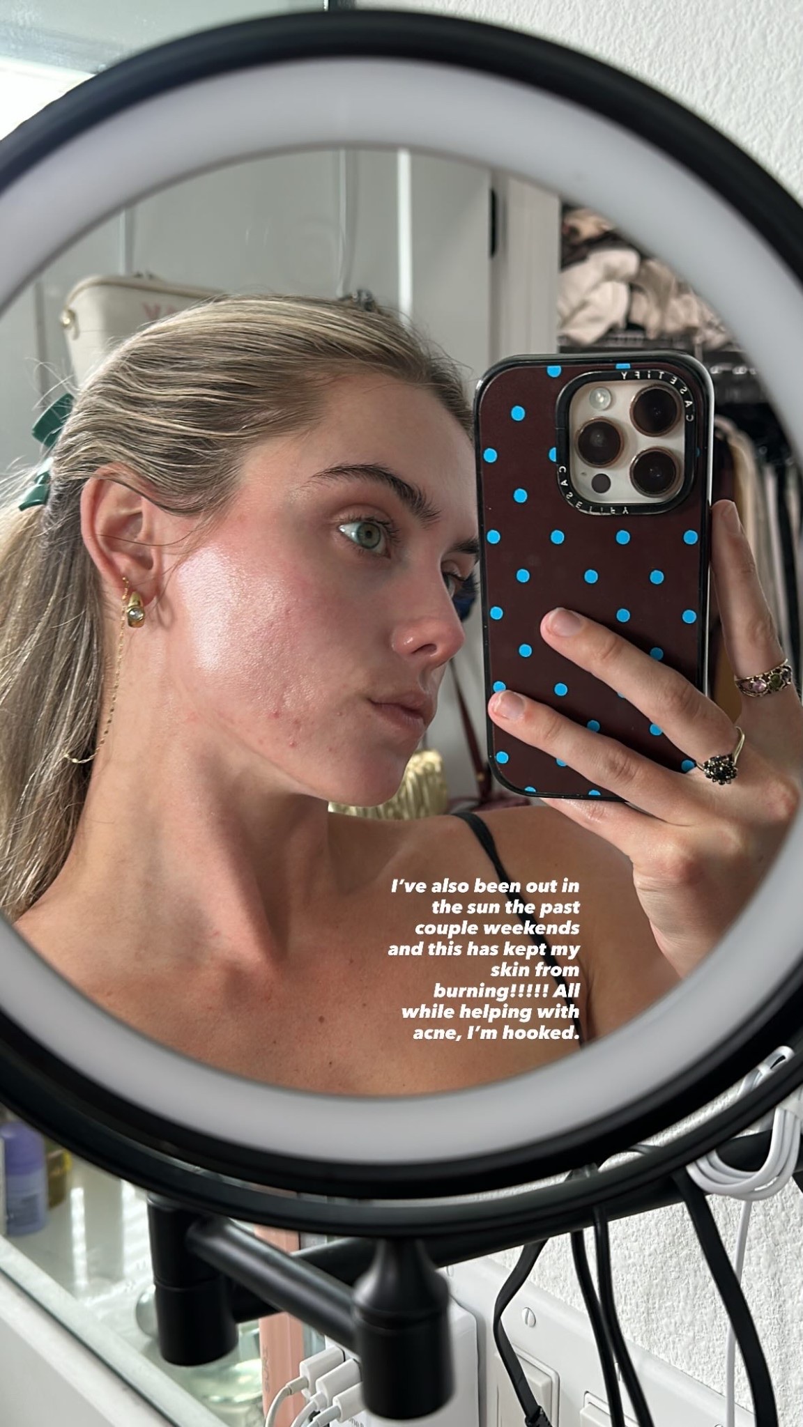I’ve also been out in the sun the past couple weekends and this has kept my skin from burning!!!!! All while helping with acne, I’m hooked.

#LTKgrwm #LTKBeauty #LTKselfcare