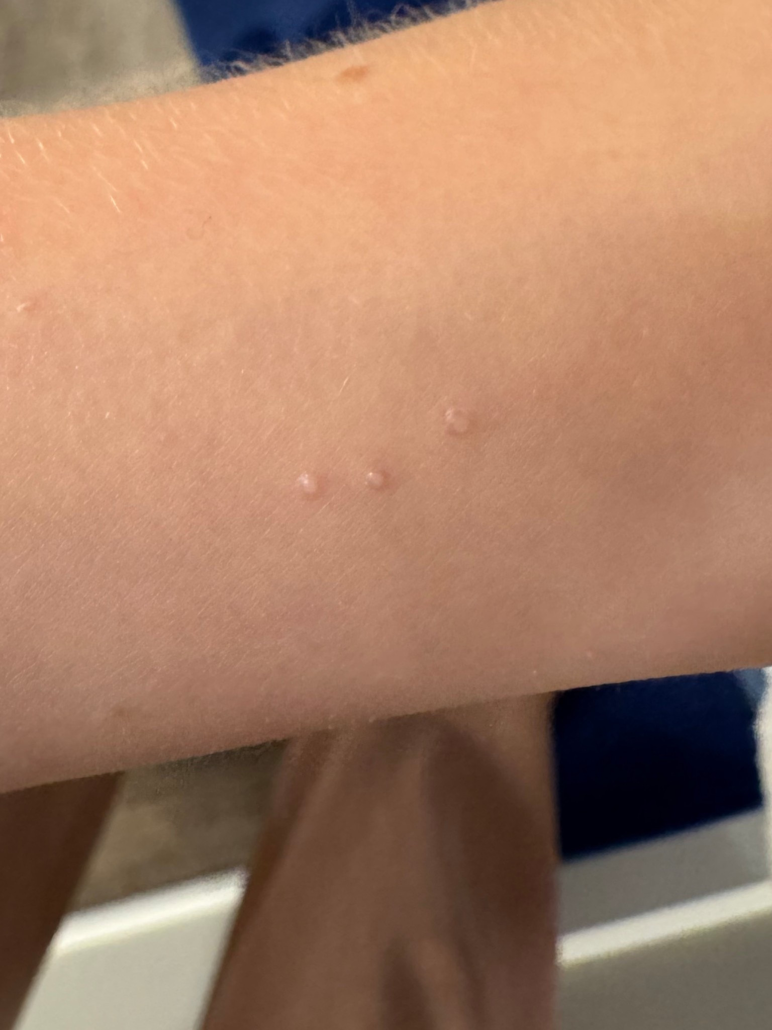 Molluscum contagiosum - remedies you all suggested! Quickest results is going to a derm and requesting a “beetle juice” treatment.

Products I can’t tag: Rowe Casa Organics: Skin Virus drops and Feet & Nail  

#LTKselfcare #LTKKids #LTKmomlife