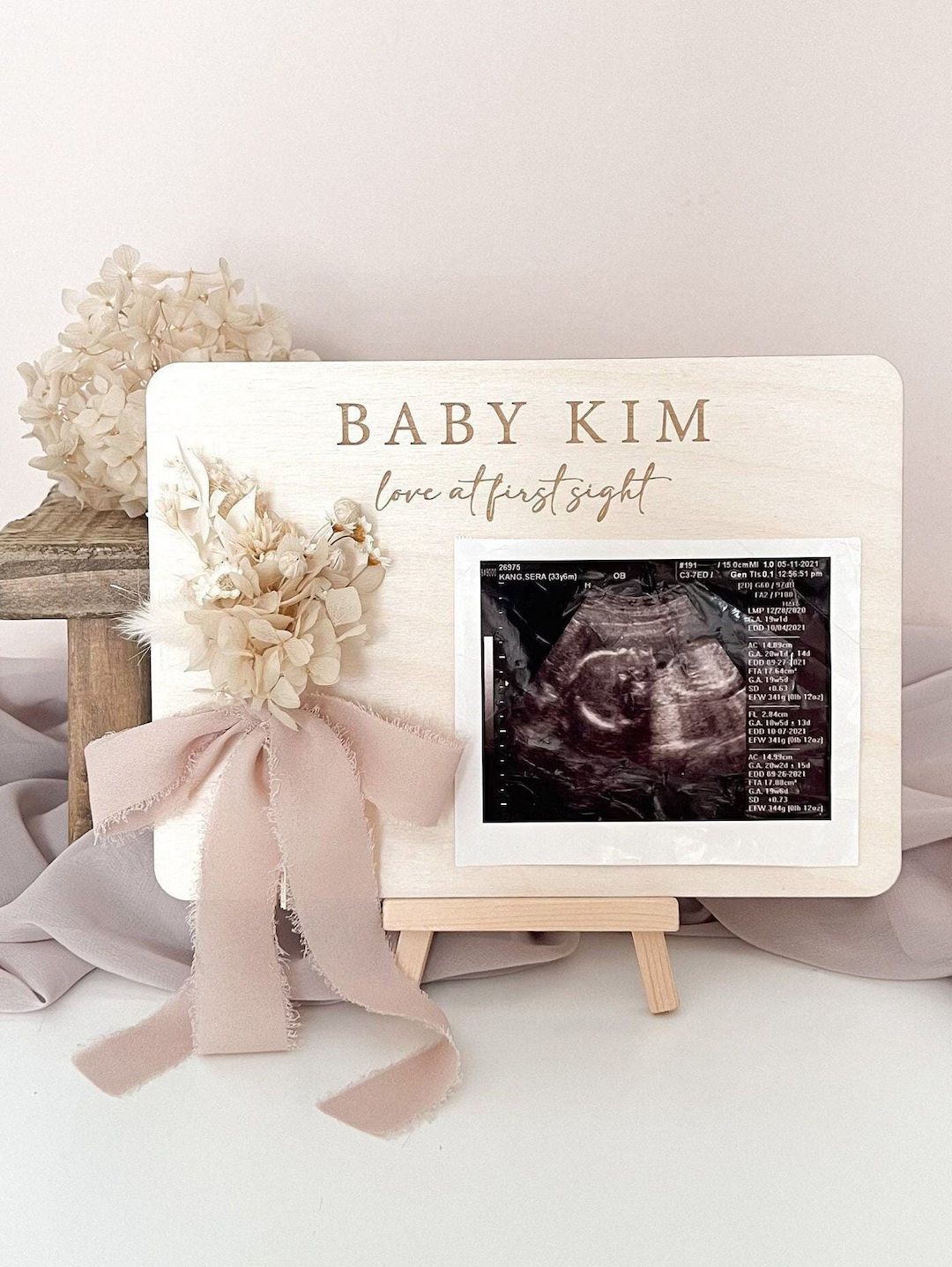 Baby Sonogram Ultrasound Photo Picture Display Sign, Personalized, Pregnancy Announcement, Custom... | Etsy (US)