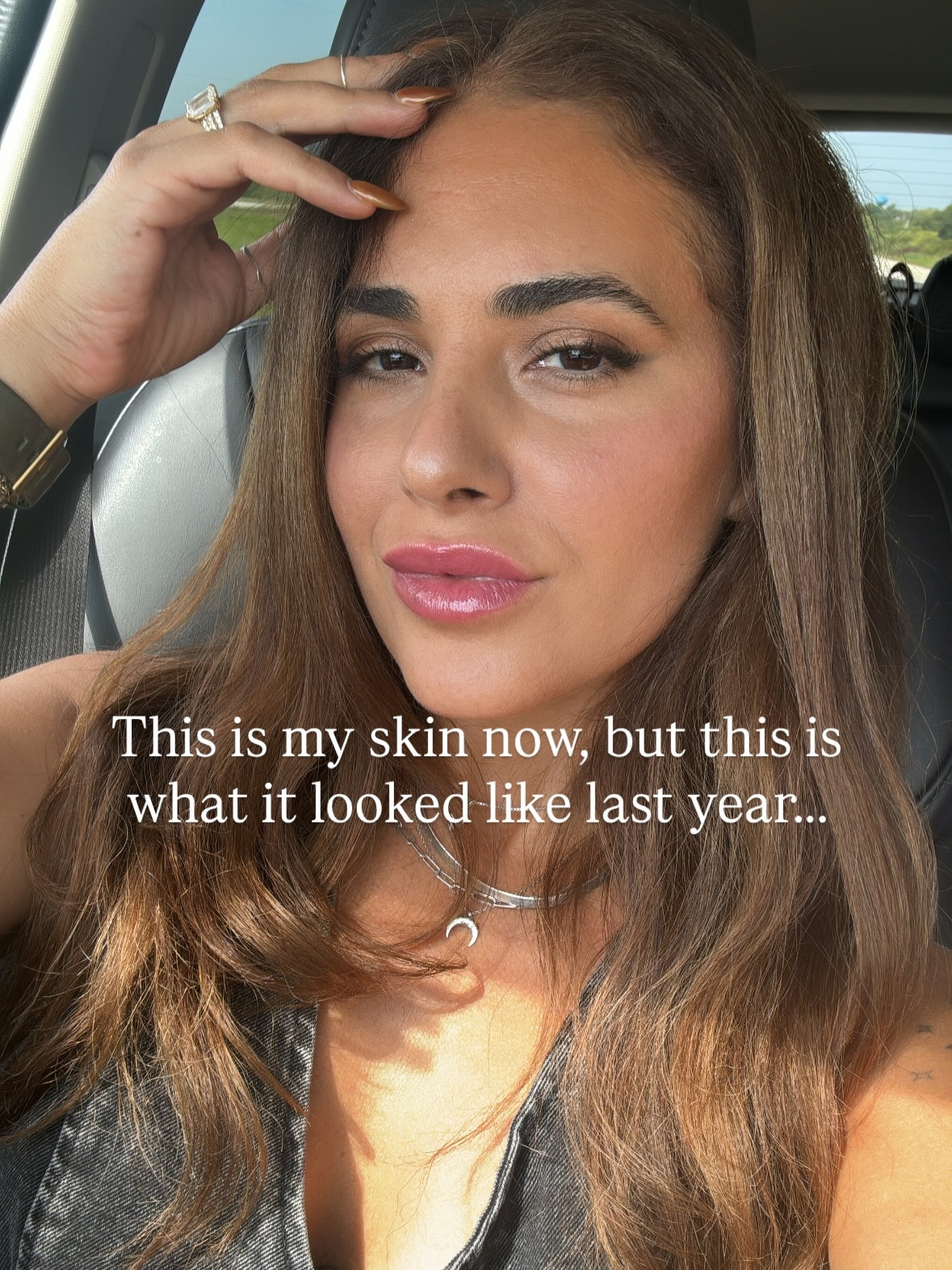 Can’t believe this was my skin last year — August 2024 (slides 2, 3 and 4). And now my skin looks like this (slides 1, 5, 6 and 7).

Glowing, hydrated, smooth, fine lines + uneven skin GONE. Reverse aging FTW 🙌🏽 (I’m wearing makeup in both before + after to keep the comparisons fair and accurate)

comment SKIN for my go-to products that have transformed tf outta my face card 🔗 

Also this is proof to myself that I look way better with anything but black hair 😂 my lawddd

https://liketk.it/5EYIj #waterlessskincare #holisticproducts #glowingskin #skintransformation #productsthatwork #koreanskincareroutine #oliveleafextract 

#LTKBeauty #LTKselfcare #LTKGiftGuide