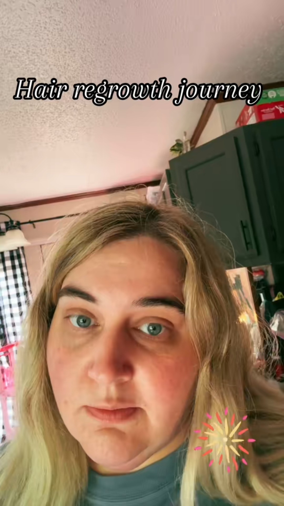 Hair regrowth journey 

#LTKBeauty #LTKPlusSize #LTKStyleTip
