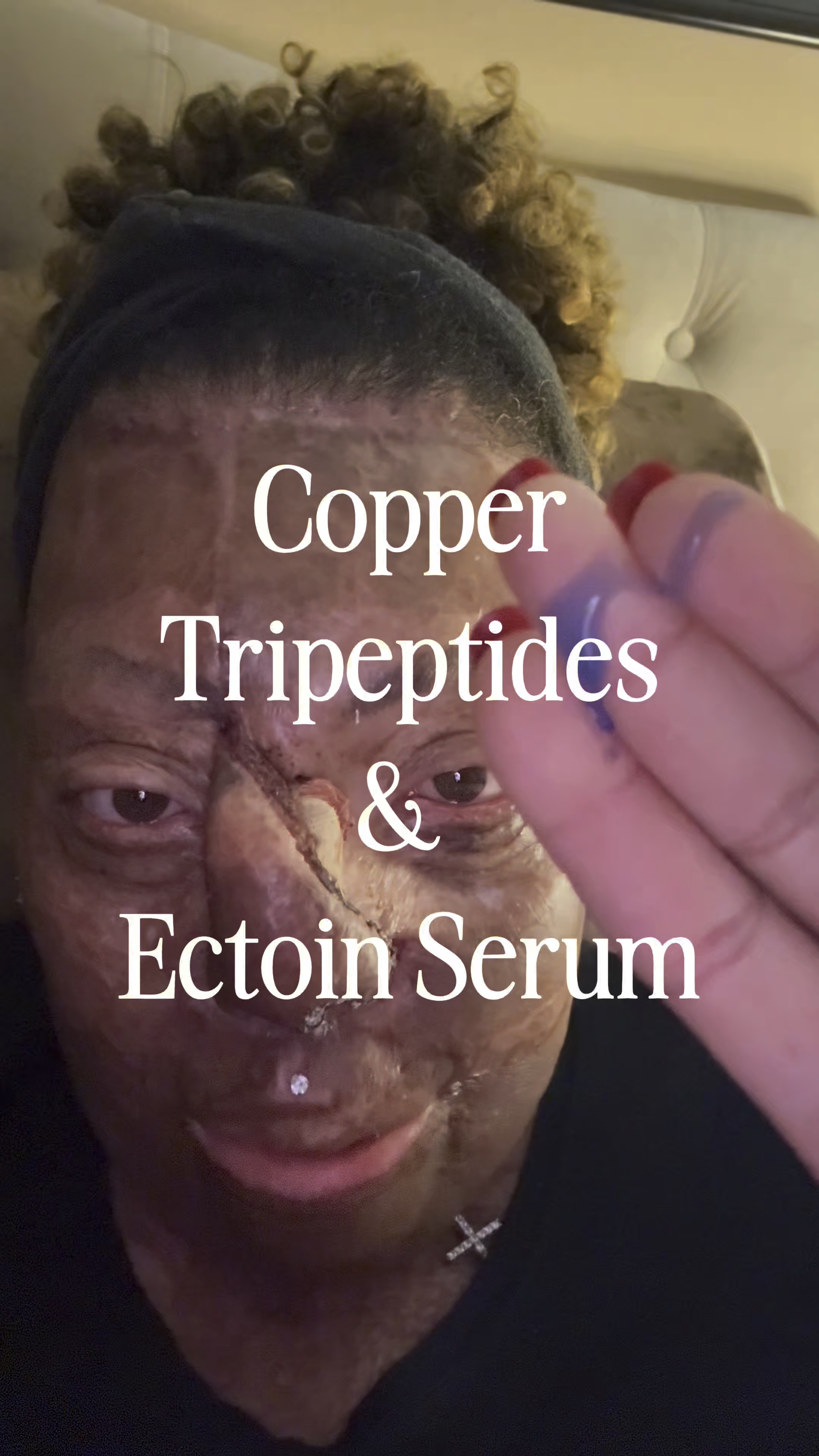 Allies of Skin Copper Tripeptides & Ectoin Serum counteracts signs of premature aging and helps repair skin.

This scar is fresh from a surgery several weeks ago. My doctor just gave me clearance to use my skin care and he was even impressed by this!

This is excellent for everyone, but especially for burns.

skincare, burn scars, moisturizer, anti aging, scars

#LTKBeauty #LTKOver40 #LTKWatchNow