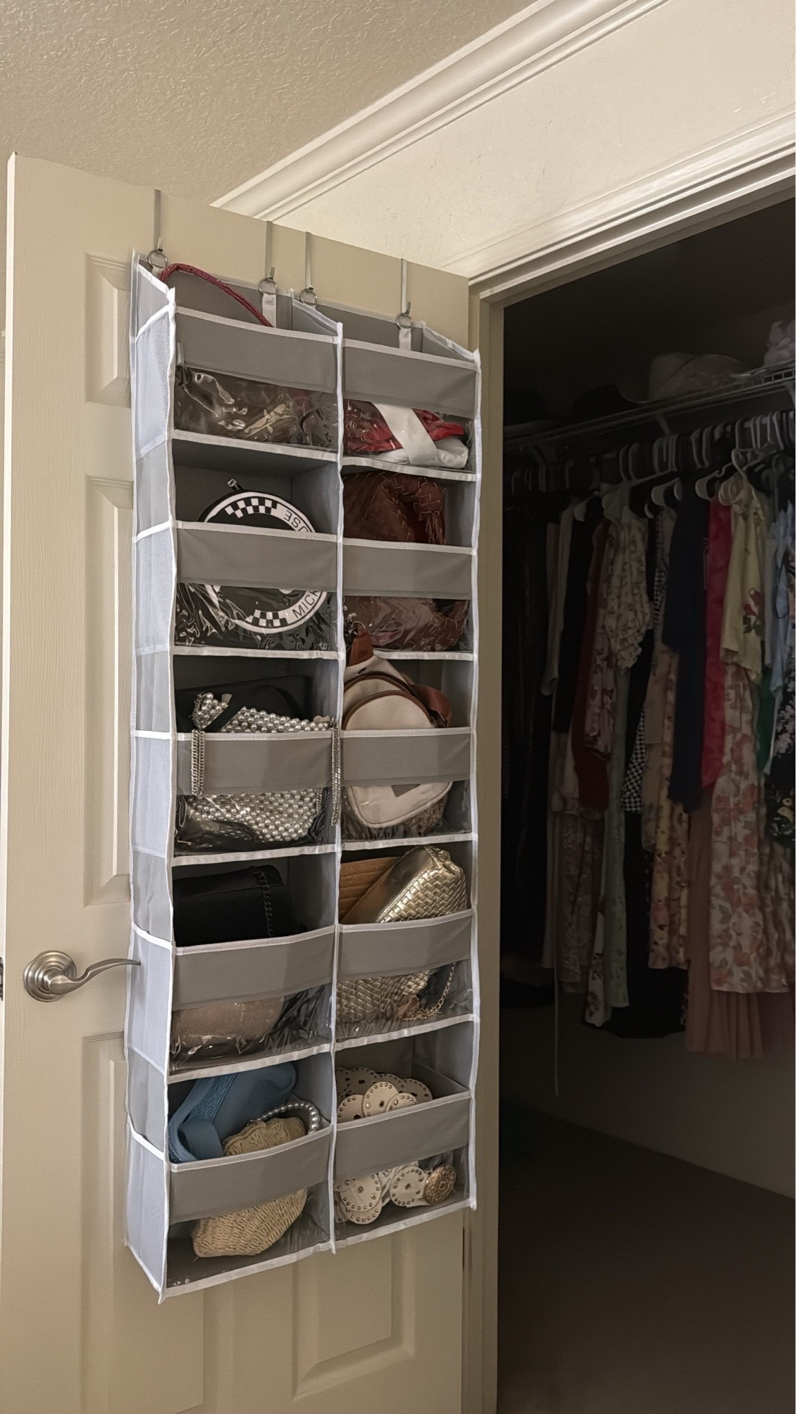 Game Changer!

My closet is looking organized!

AmazonFinds
AmazonOrganization

#LTKdayinmylife #LTKstorytime #LTKHome